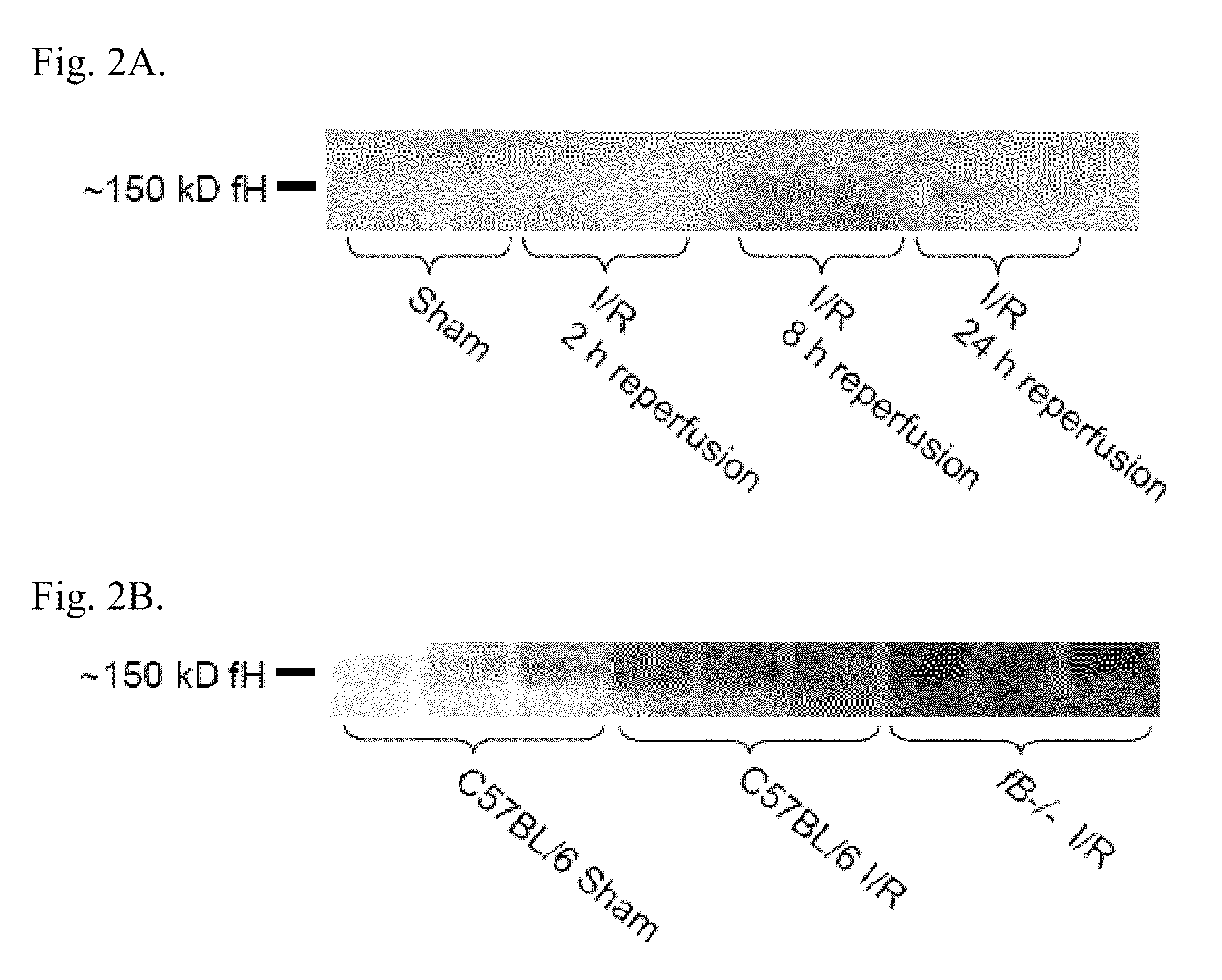 Modulating the alternative complement pathway