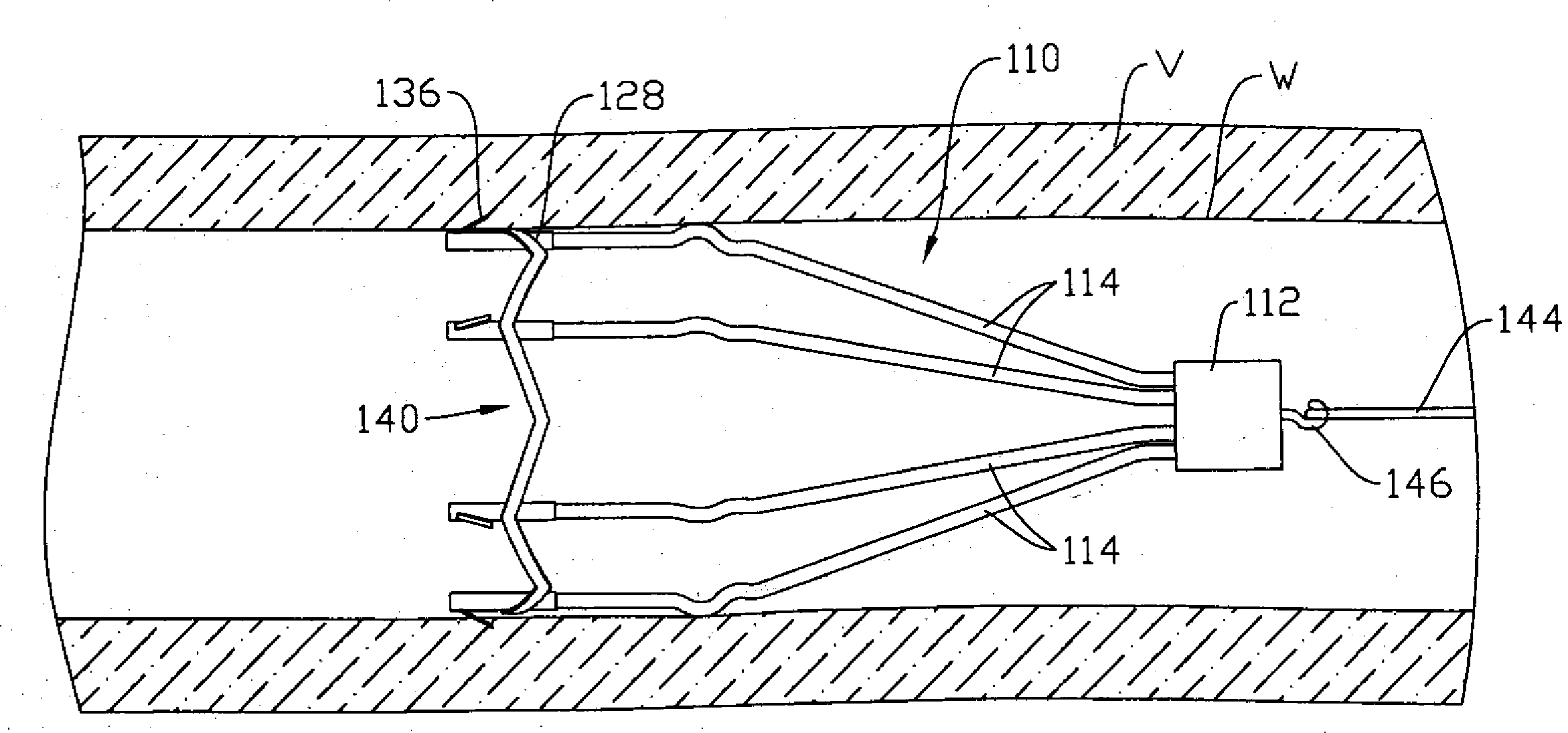 Retrievable ivc filter