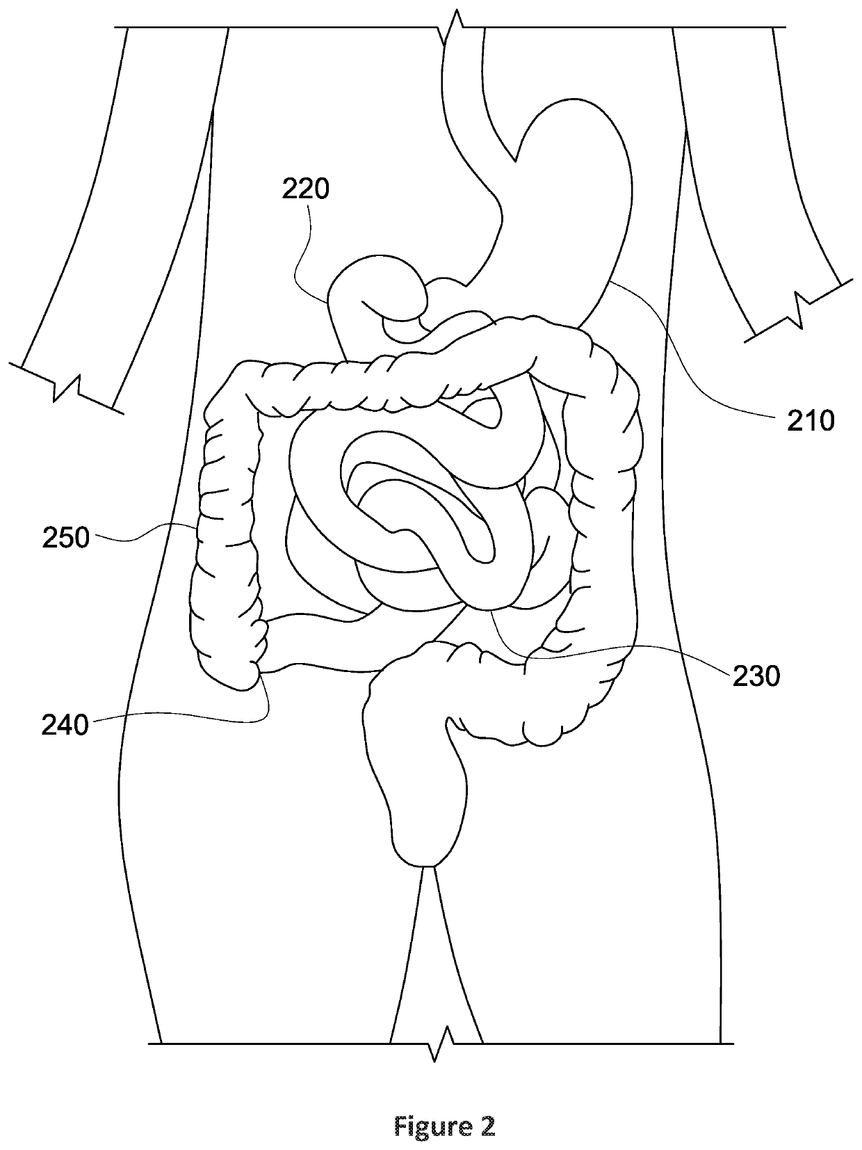 Magnetic devices, systems, and methods