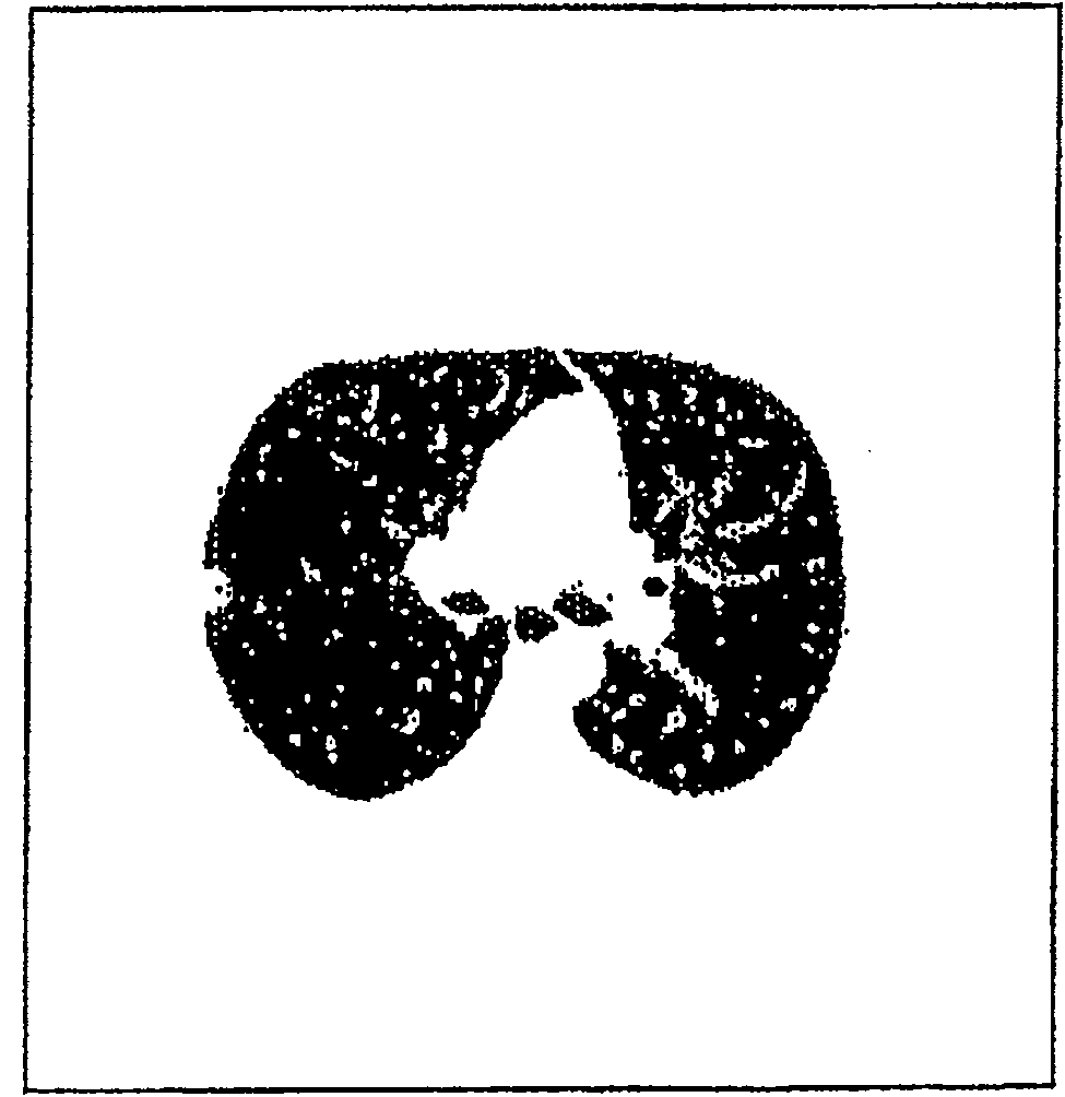 Method and device for forming an isolated visualization of body structures