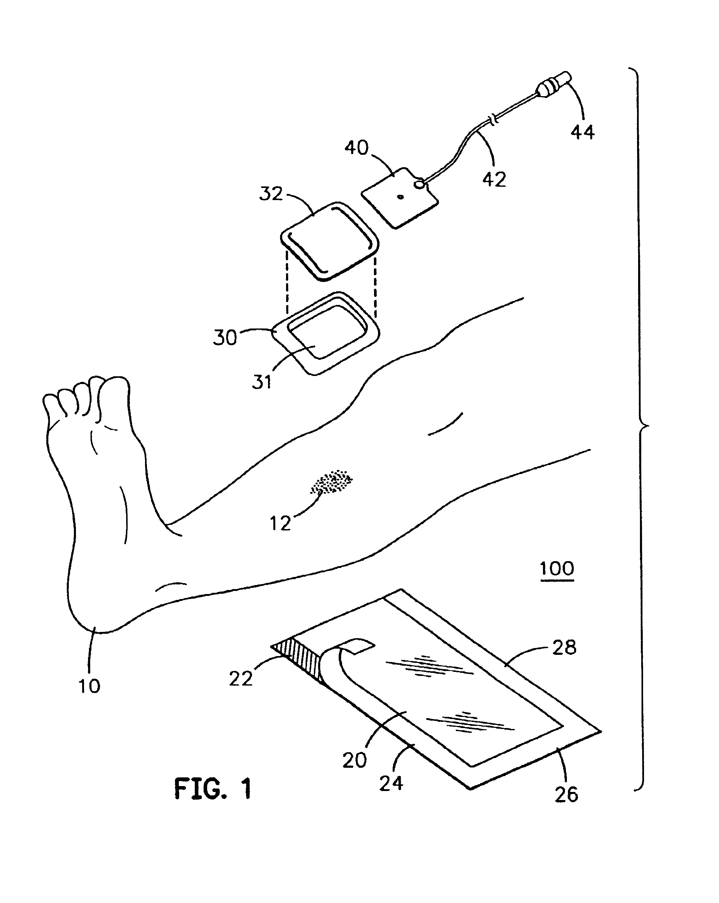 Modular bandage