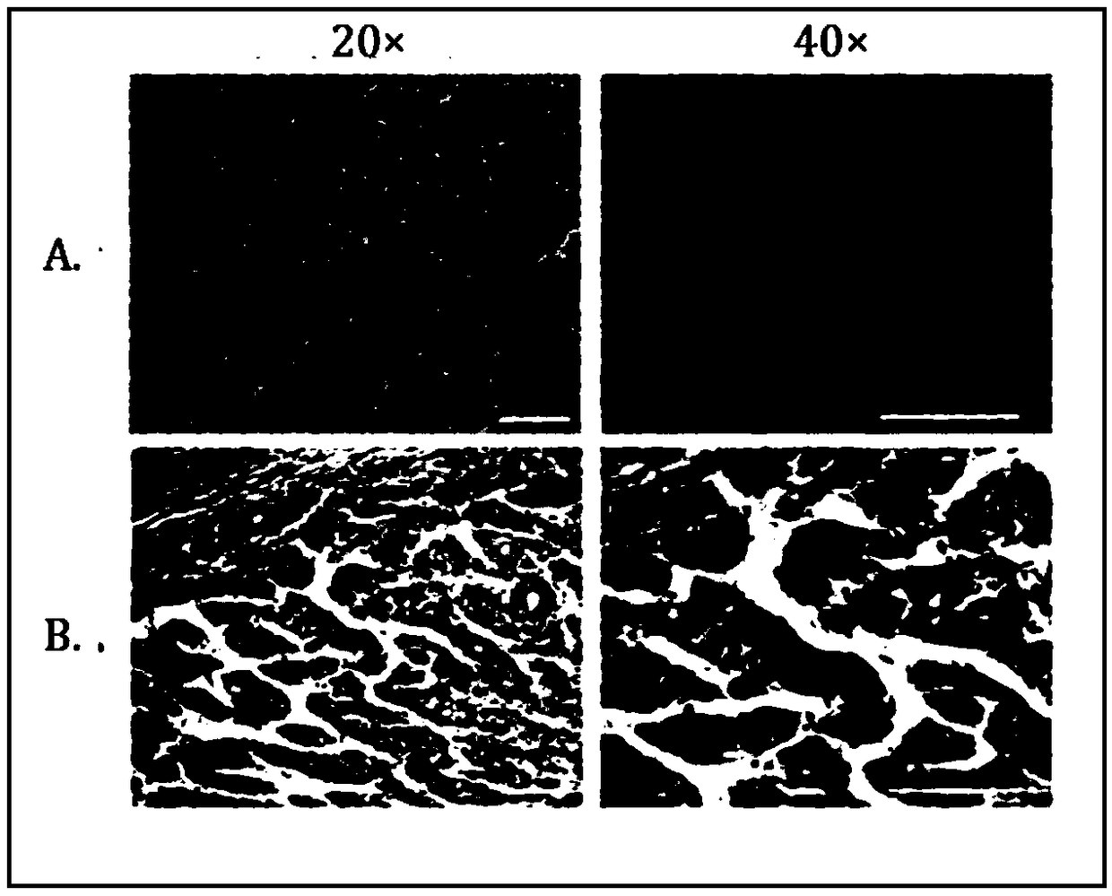 Hybridoma cell, monoclonal antibody for anti-human cyclophilin A and application thereof