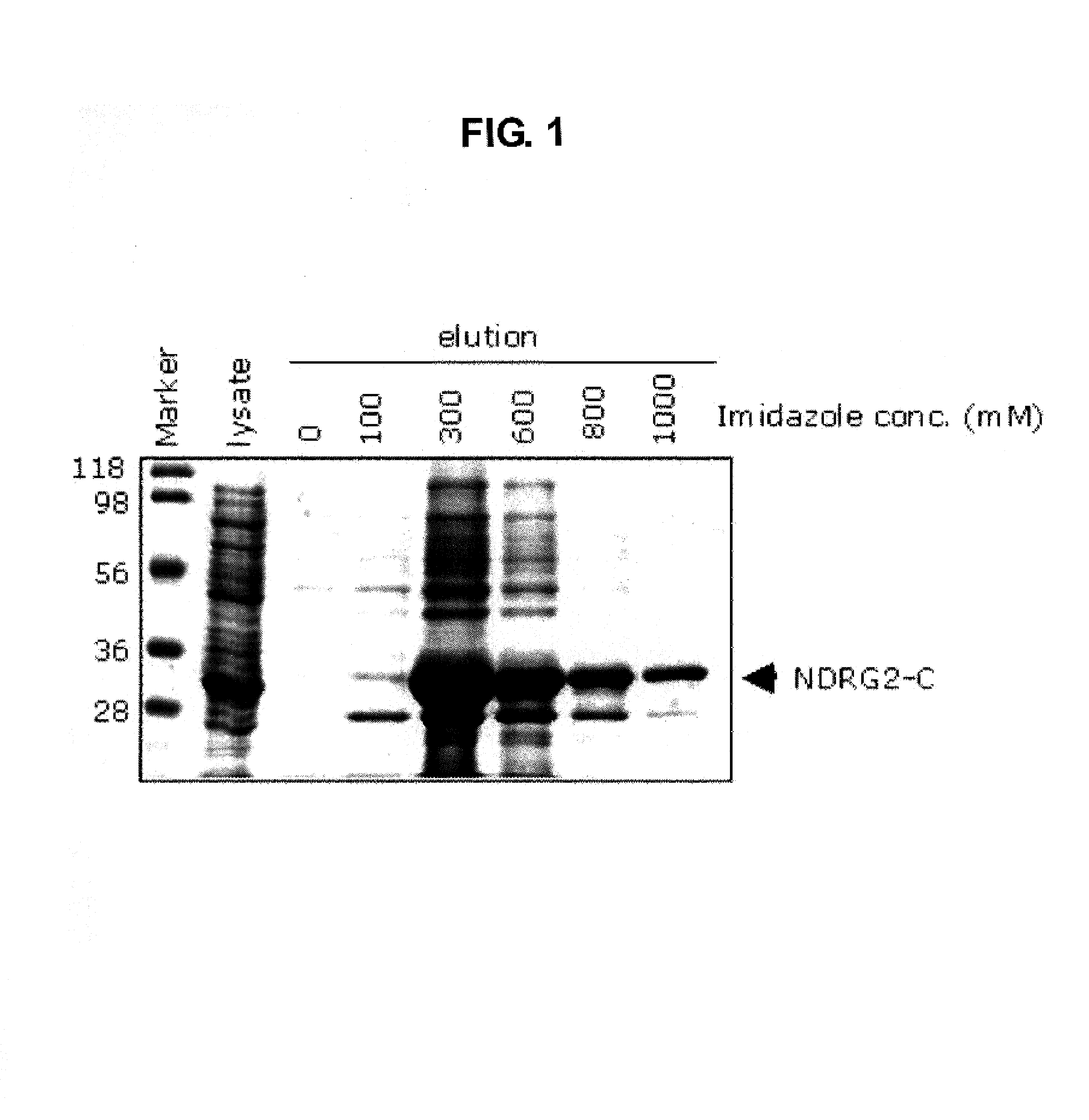 Preparation of monoclonal antibody to N-myc downstream regulated gene 2 and determination of NDRG2 using protein chip