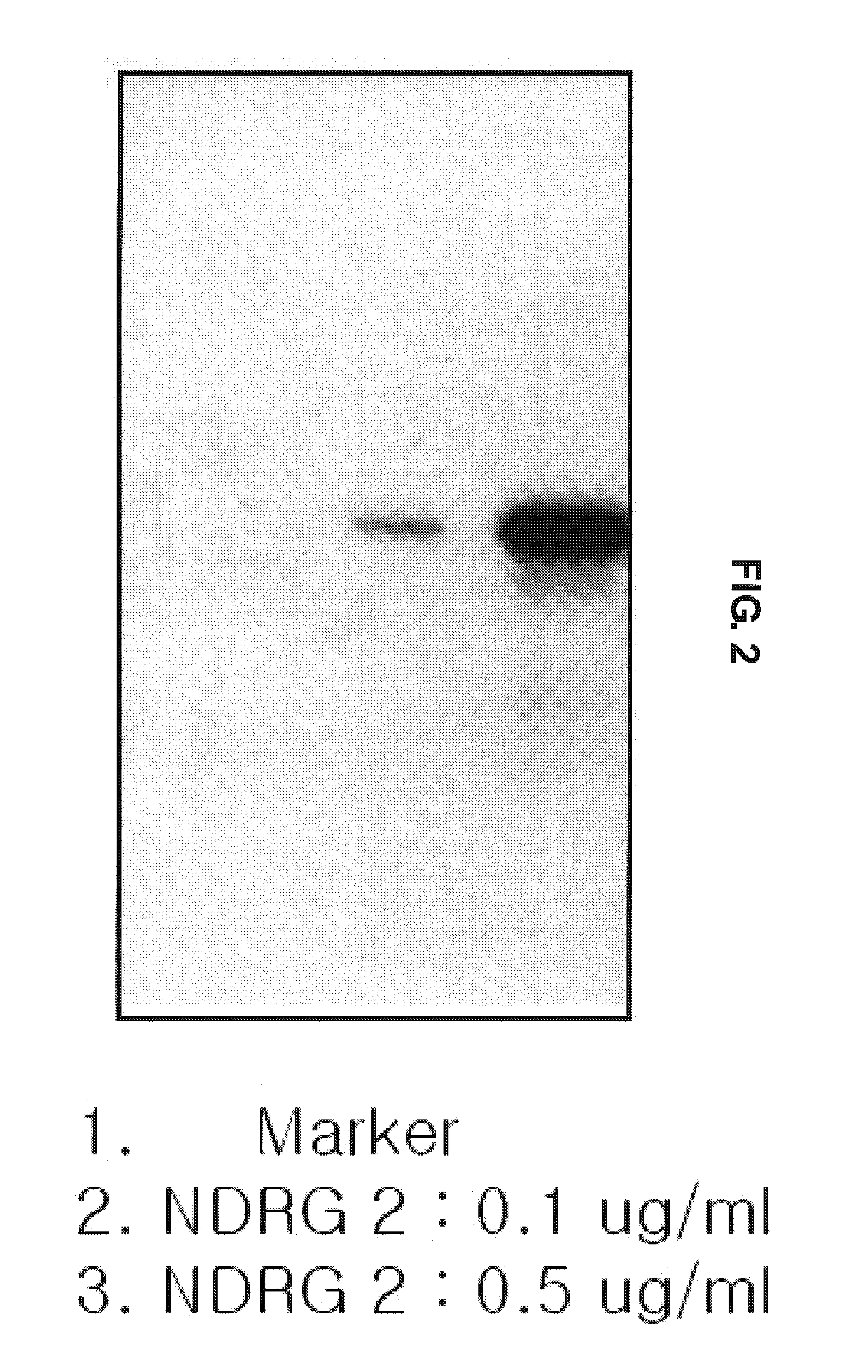 Preparation of monoclonal antibody to N-myc downstream regulated gene 2 and determination of NDRG2 using protein chip