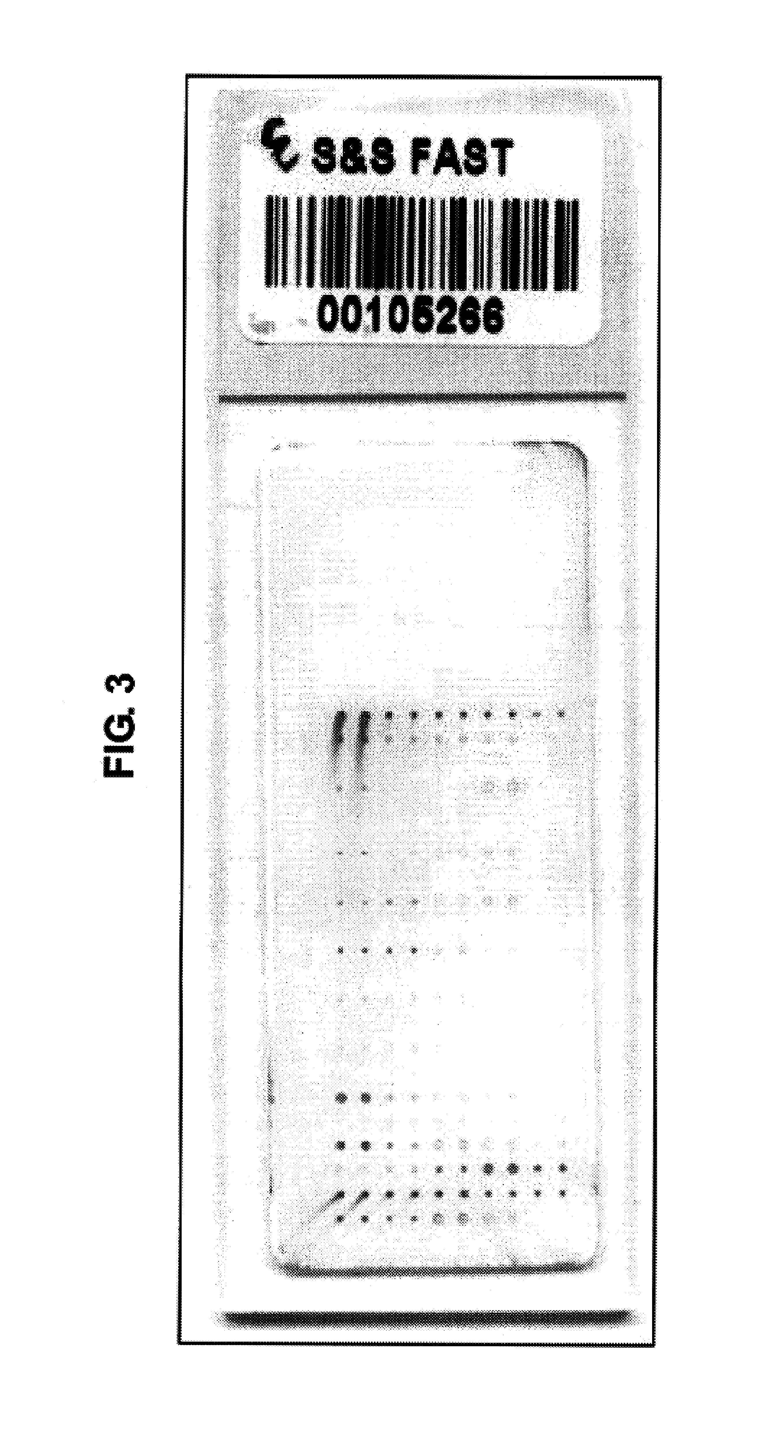 Preparation of monoclonal antibody to N-myc downstream regulated gene 2 and determination of NDRG2 using protein chip