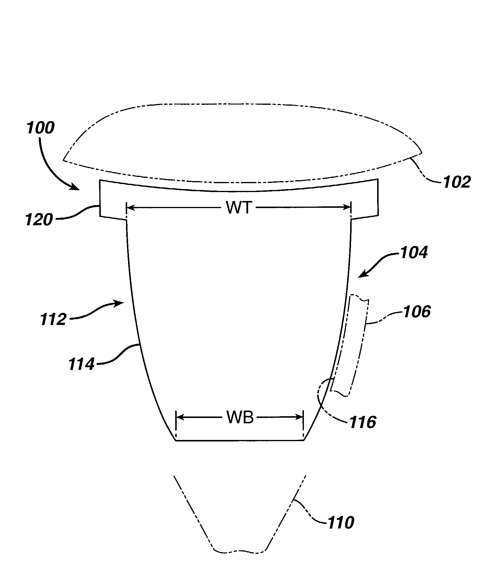 Concave resurfacing prosthesis