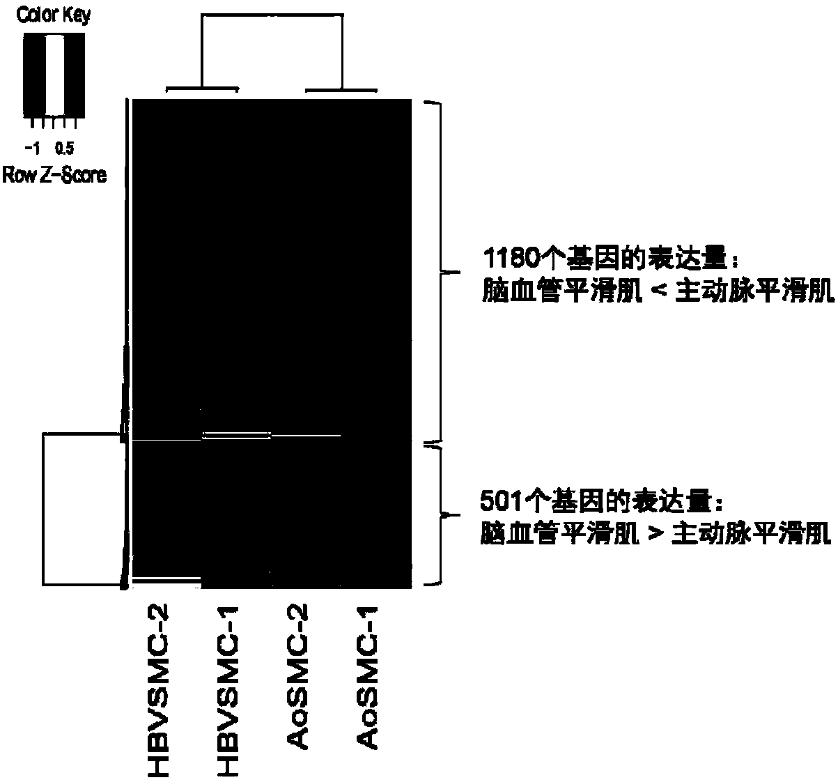 Application of apigenin in preparation of medicine for preventing and treating hemorrhagic cerebrovascular disease and ischemic cerebrovascular disease caused by high blood pressure