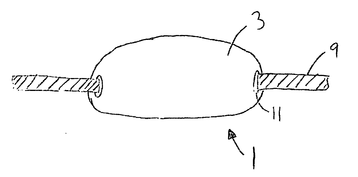 Post decannulation stoma cover