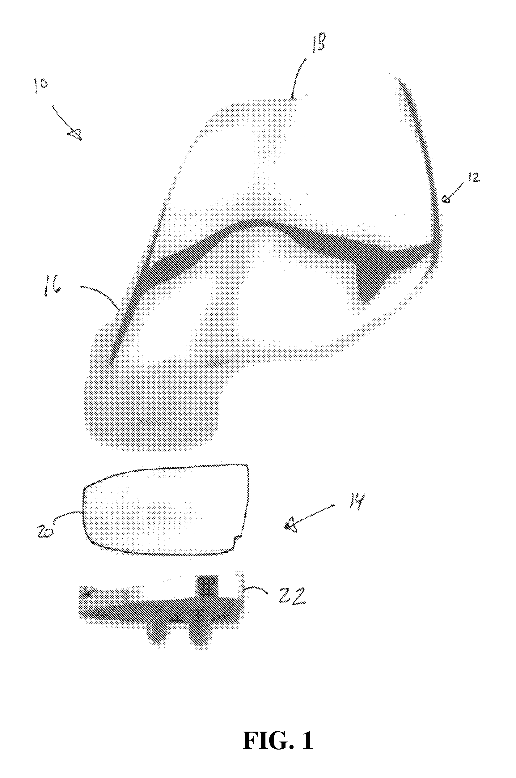 Method and system for computer assisted surgery for bicompartmental knee replacement