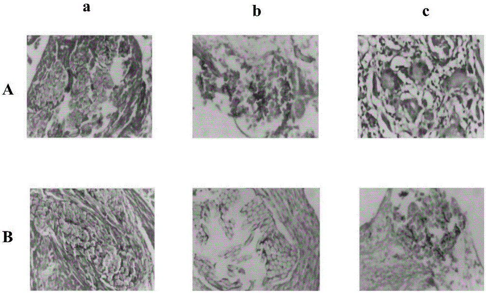 A kind of medical suture and preparation method thereof