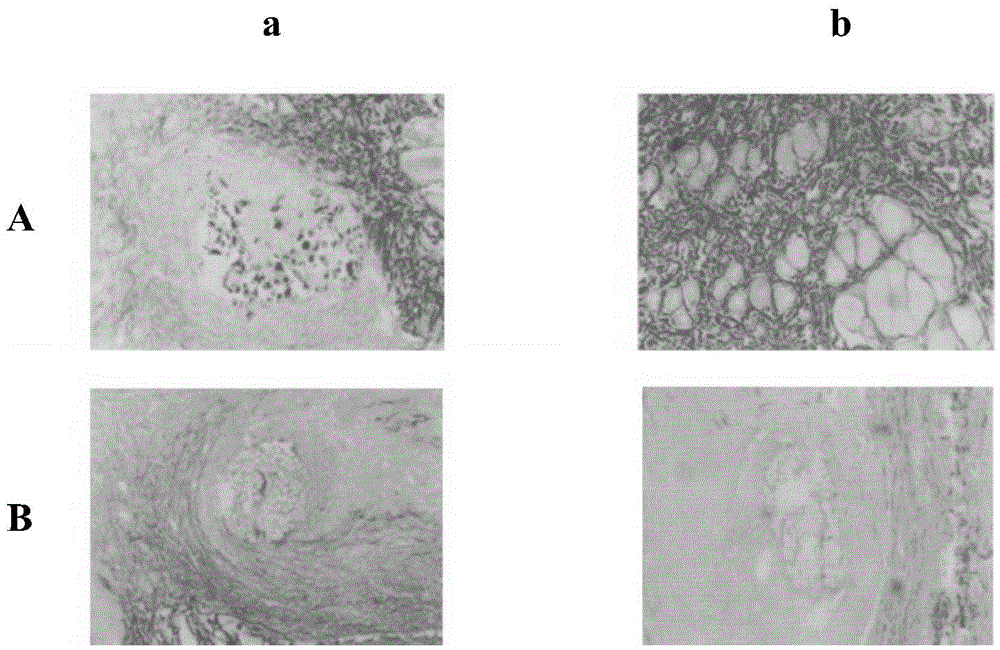 A kind of medical suture and preparation method thereof