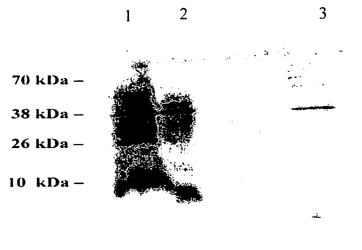 Plant-derived elastin binding protein ligands and methods of using the same