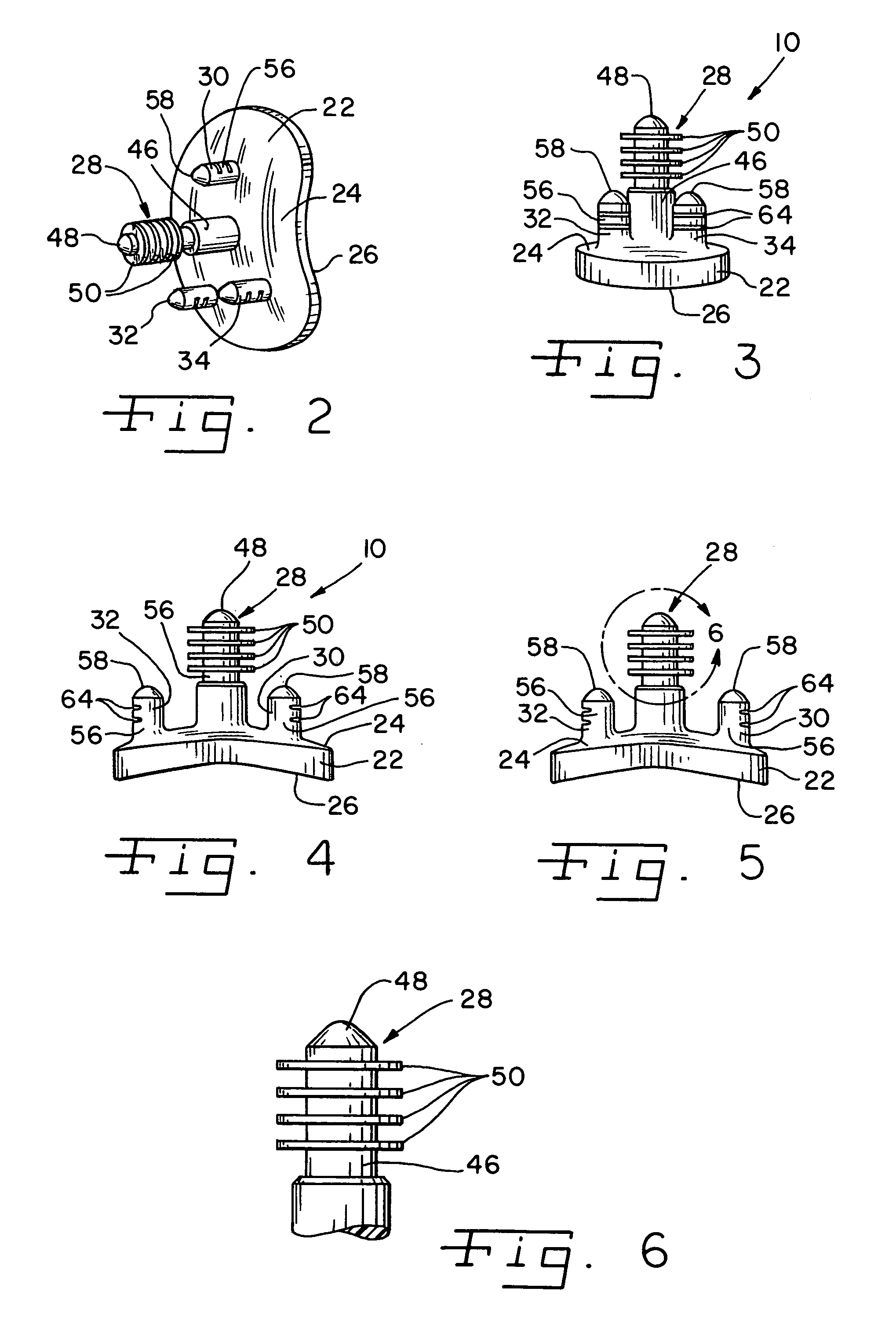 Method for securing a glenoid component to a scapula