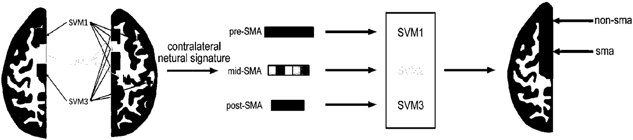 Functional positioning method for supplementary motor area based on resting state