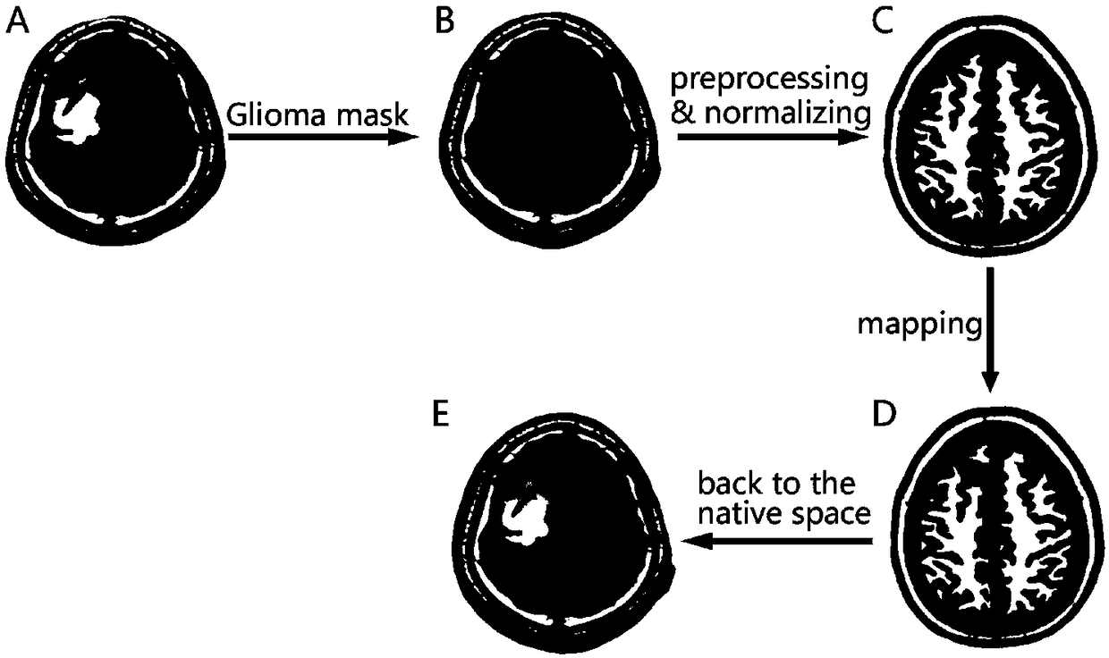 Functional positioning method for supplementary motor area based on resting state