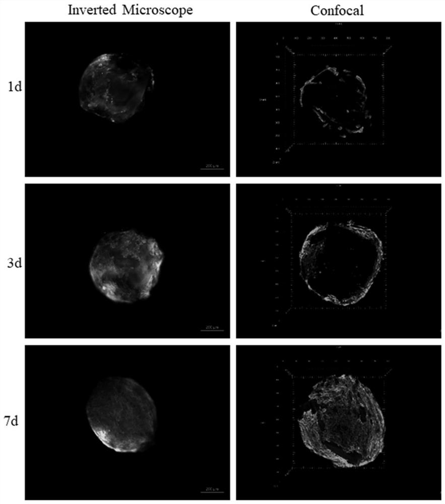 Application of honeycomb-shaped GelMA microspheres in construction of tumor model