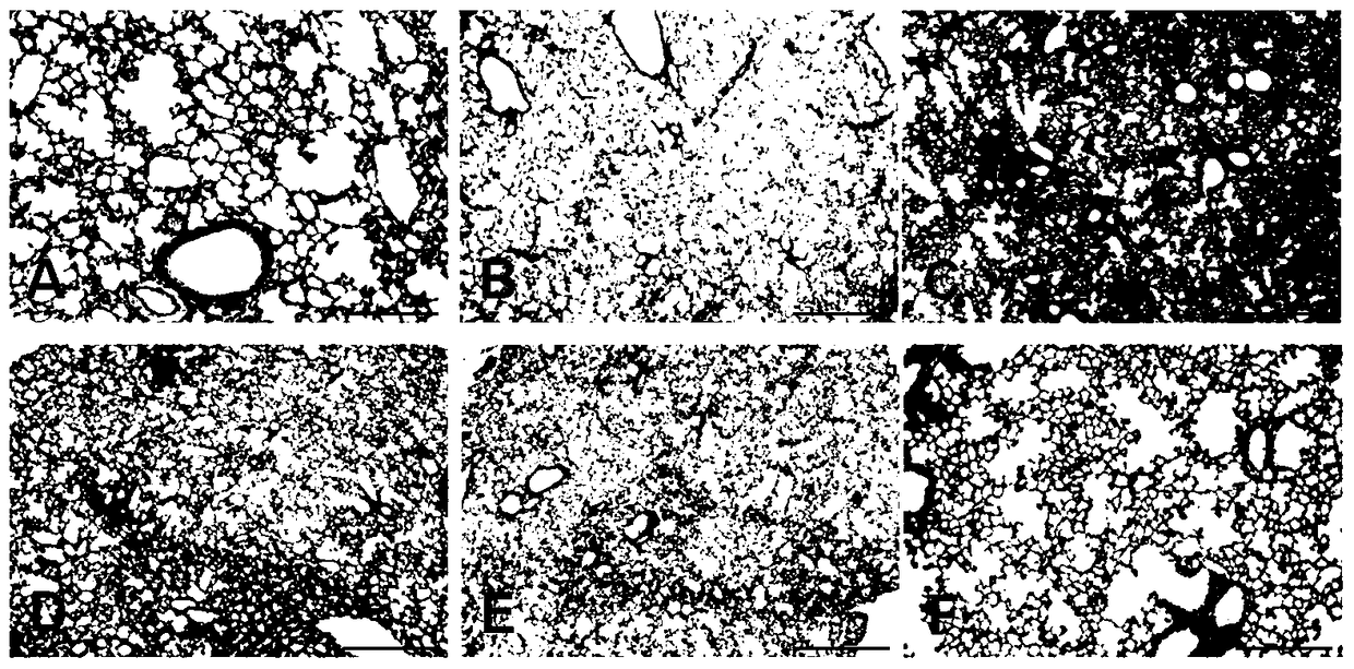 Application of a sesquiterpene compound in the preparation of drugs for inhibiting acute inflammation