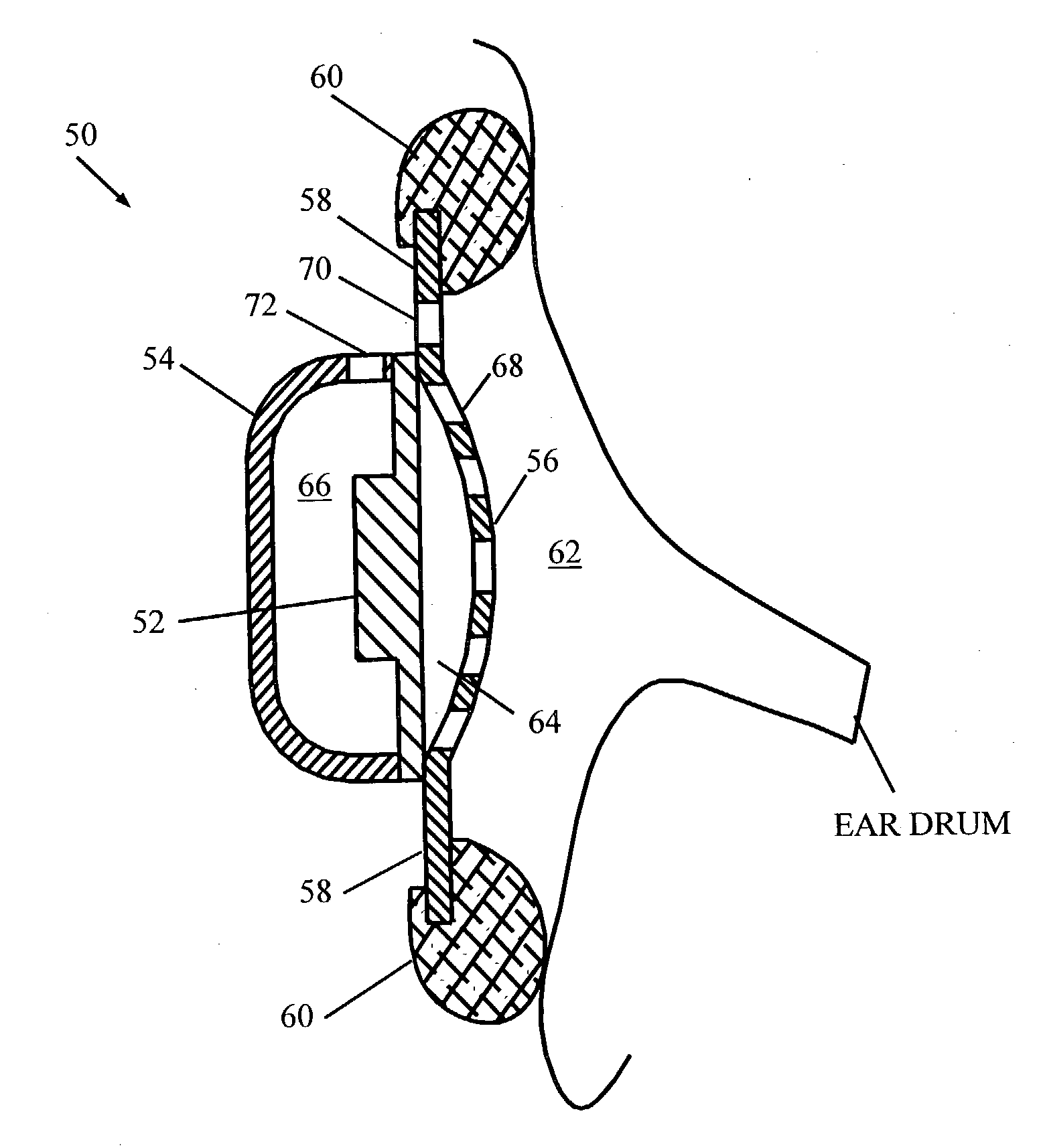 Personal communication method and apparatus with reduced audio leakage