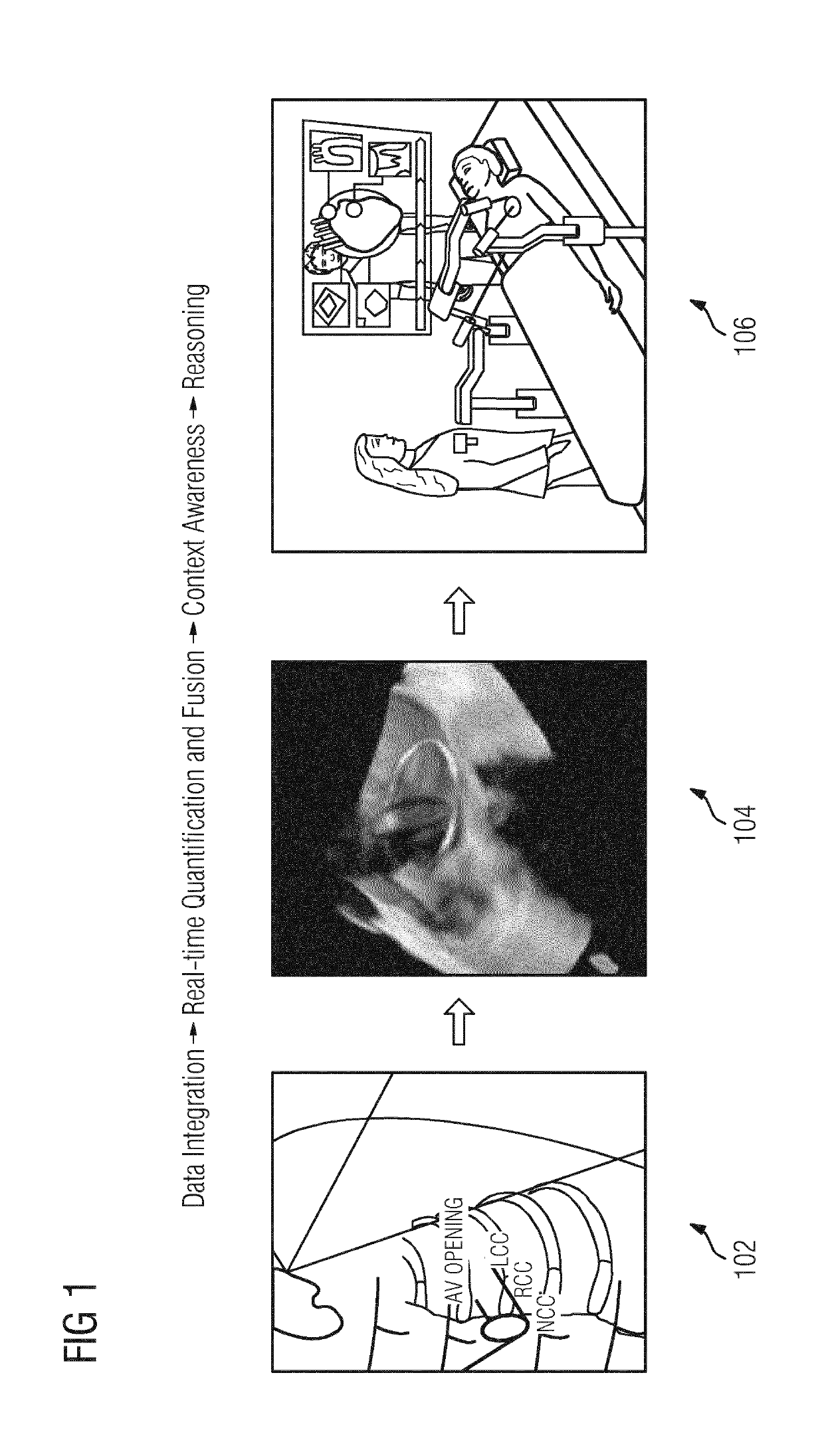 System and method for artificial agent based cognitive operating rooms