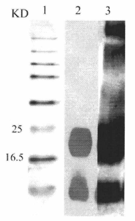 Heavy and light chain variable region gene of monoclonal antibody resisting human amyloid protein, and its uses