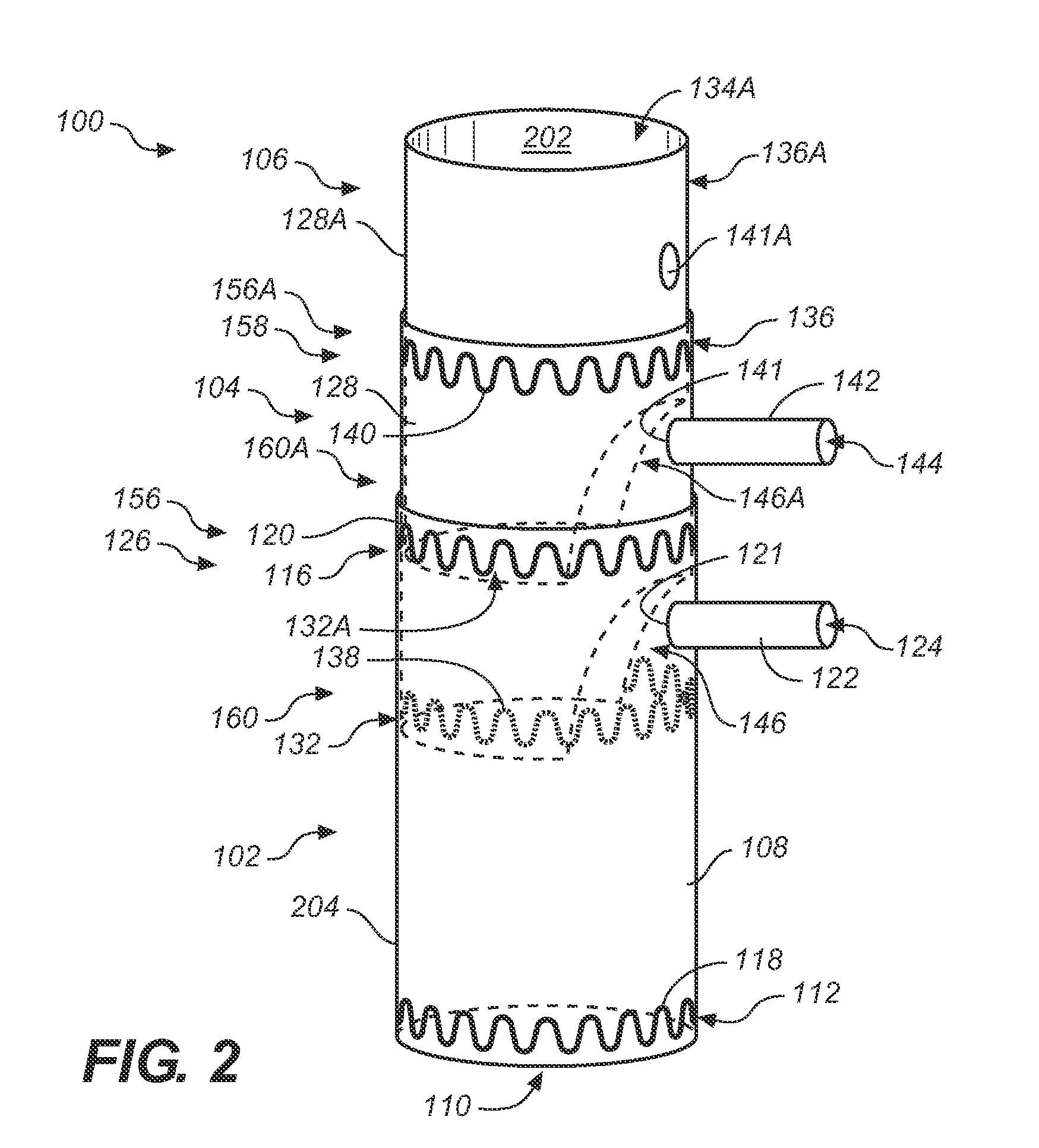 Extender Cuff for Branch Vessel