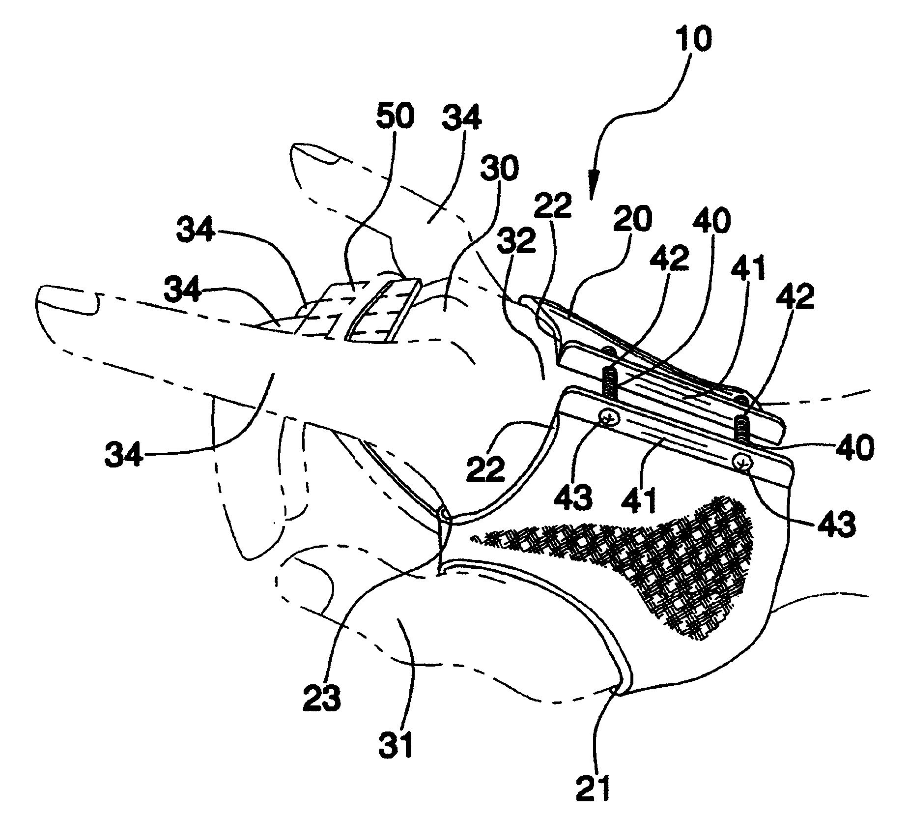 Dynamic dorsal-blocking adjustable splint