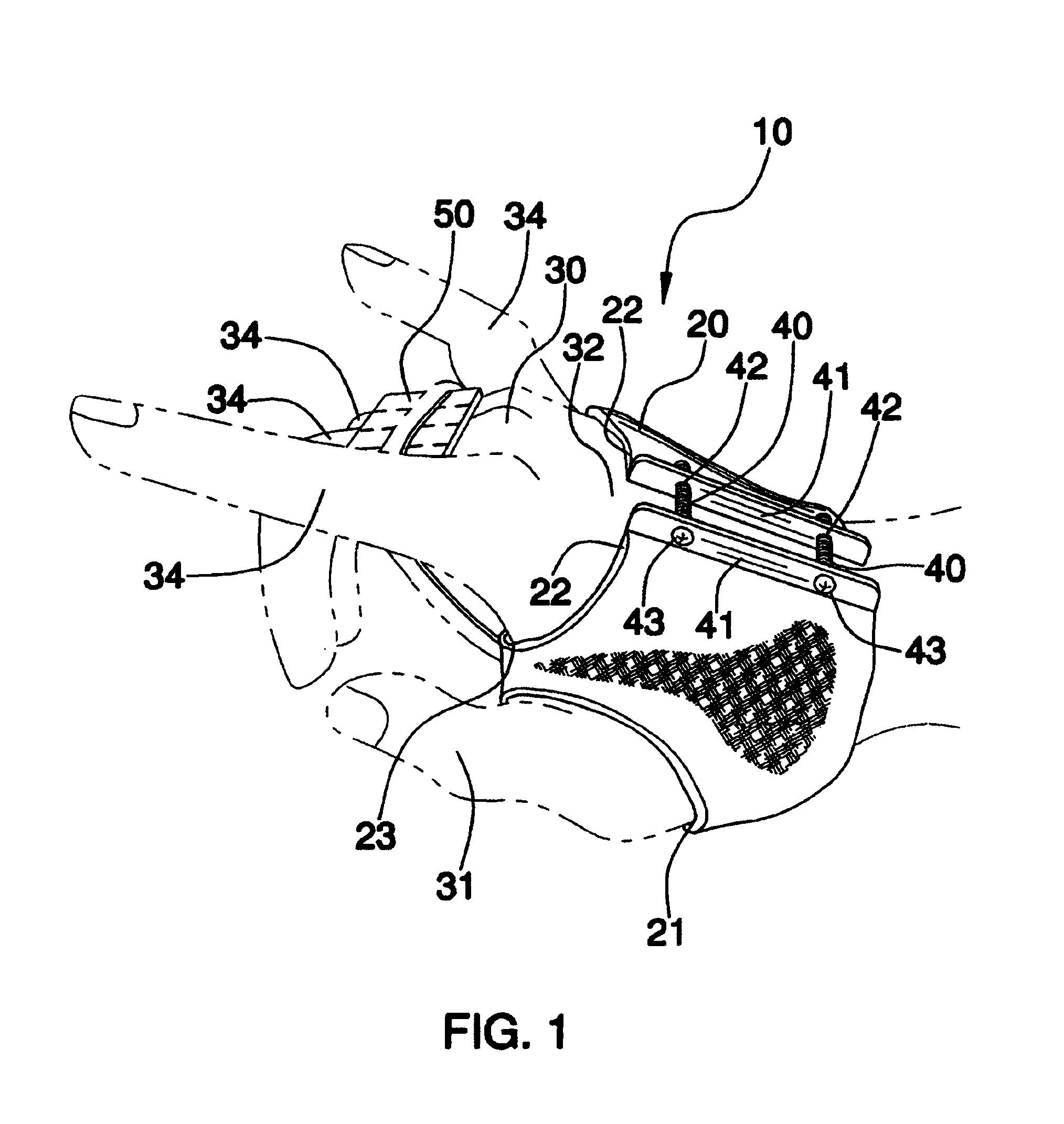 Dynamic dorsal-blocking adjustable splint