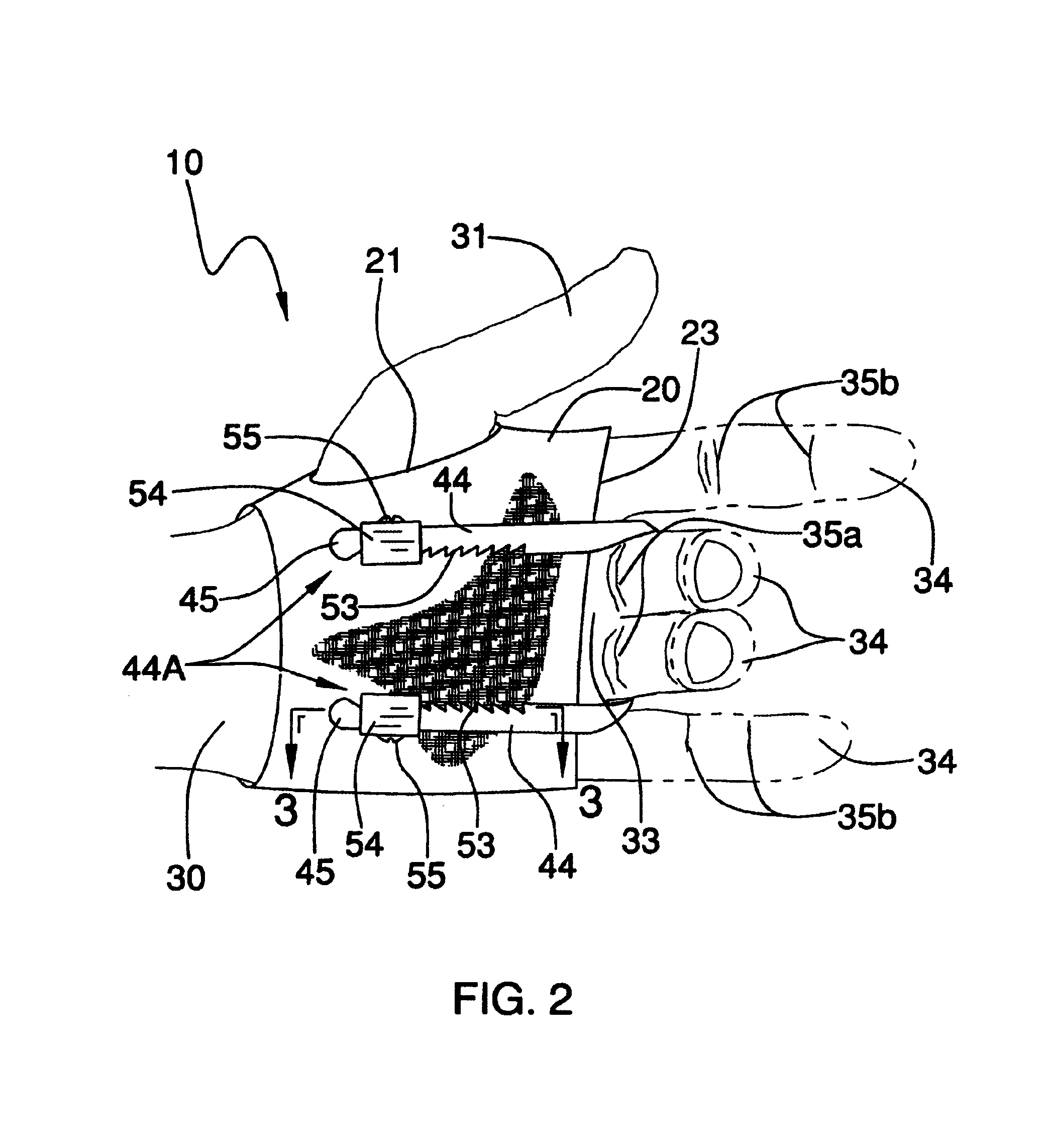 Dynamic dorsal-blocking adjustable splint