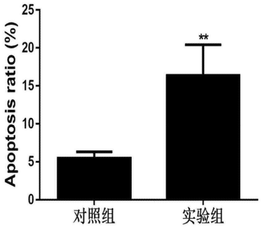 Molecular marker for early warning of atherosclerosis and application of molecular marker