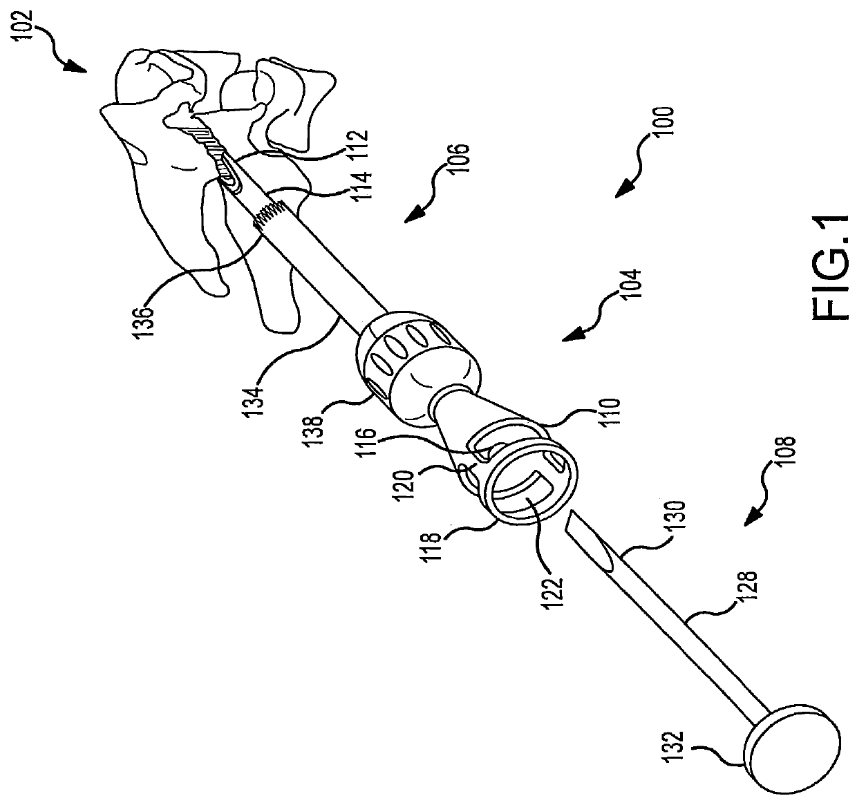 Vertebral joint implants and delivery tools