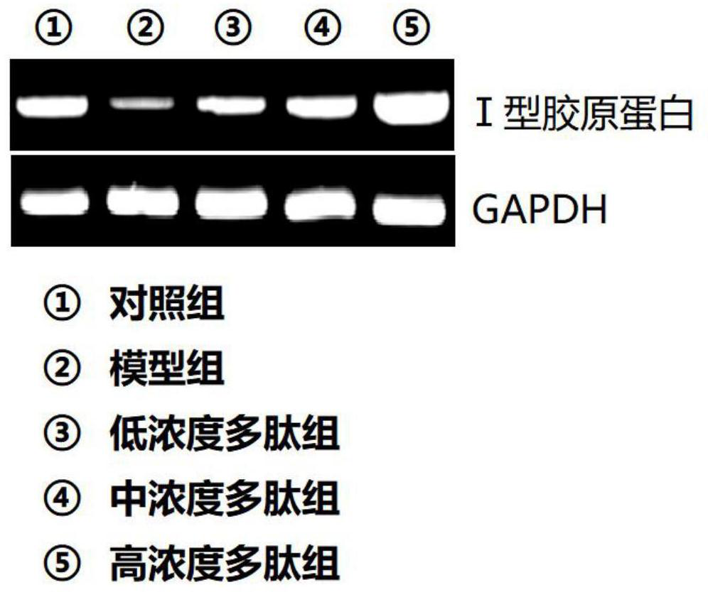 Plant-derived polypeptide with anti-aging effect, face cream containing plant-derived polypeptide and preparation method of face cream