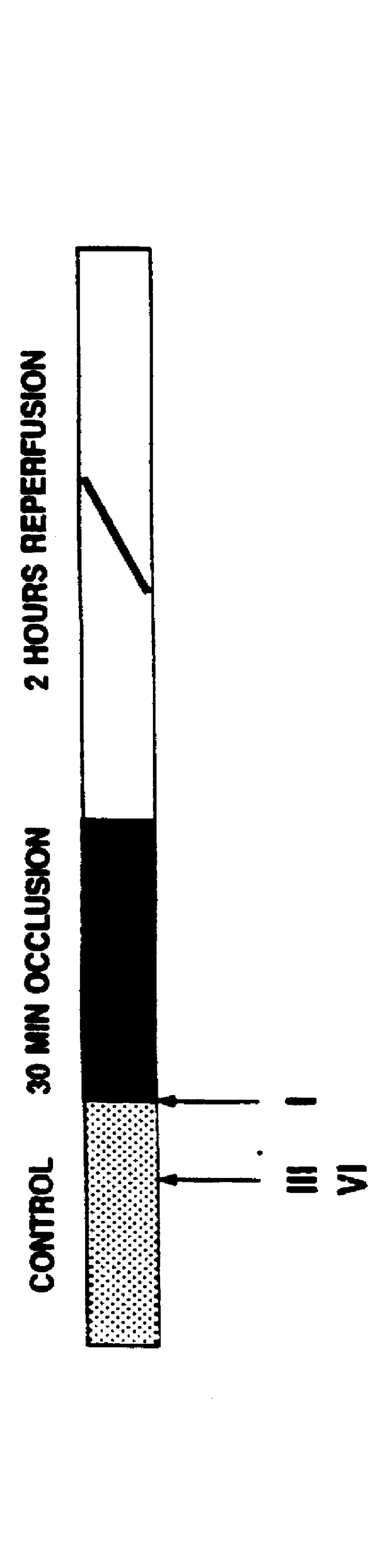 Ischemic preconditioning