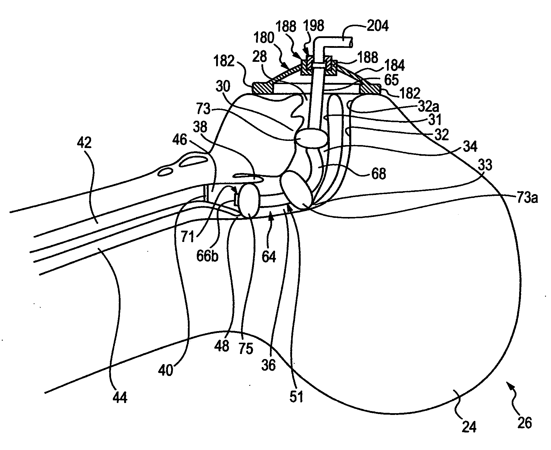 Airway device and methods of making and use thereof