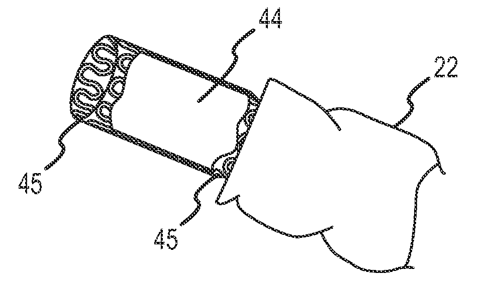 Methods and apparatus for surgical anastomosis