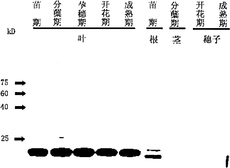 Acyl carrier protein III epitope, acyl carrier protein III antibody and use thereof