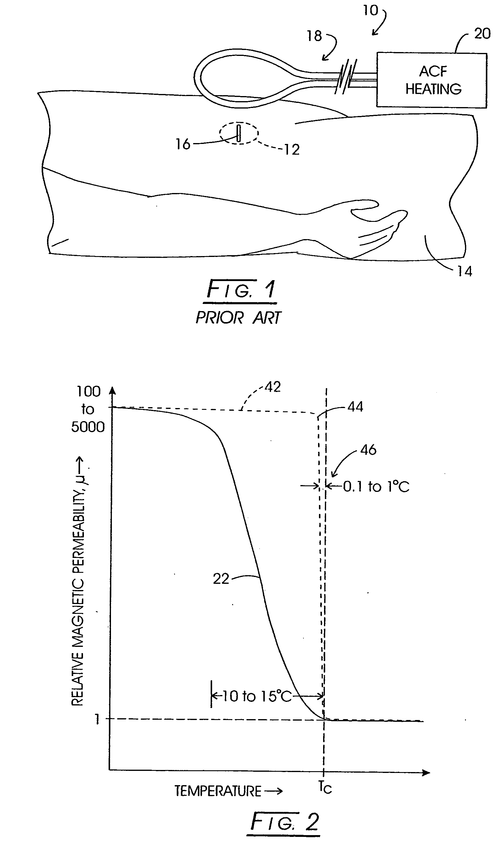 System method and apparatus for localized heating of tissue