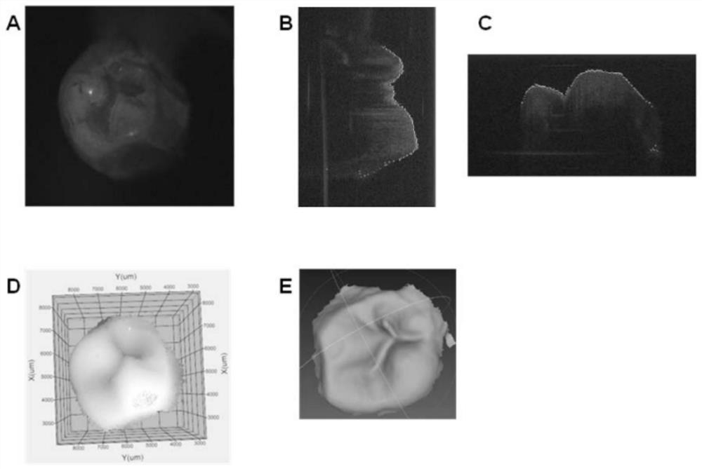 Optical tomography digital impression imaging system and using method thereof