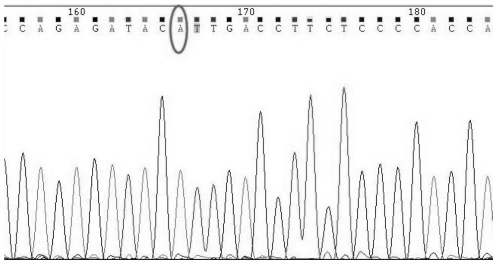 A gene detection kit for individualized medication of antiepileptic drugs and its application