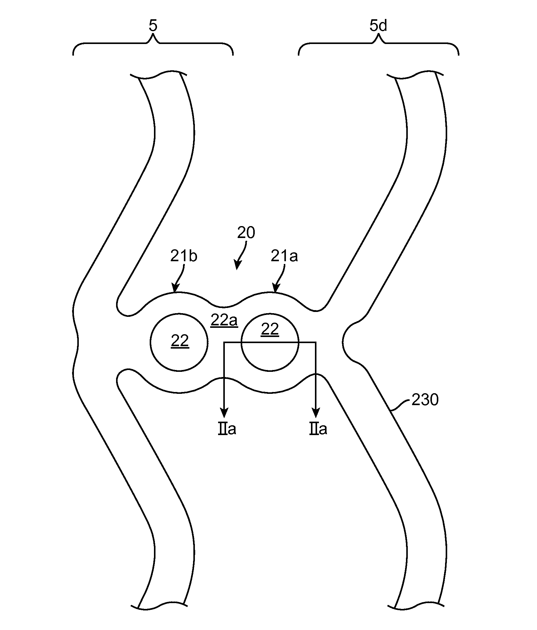 Scaffolds having radiopaque markers