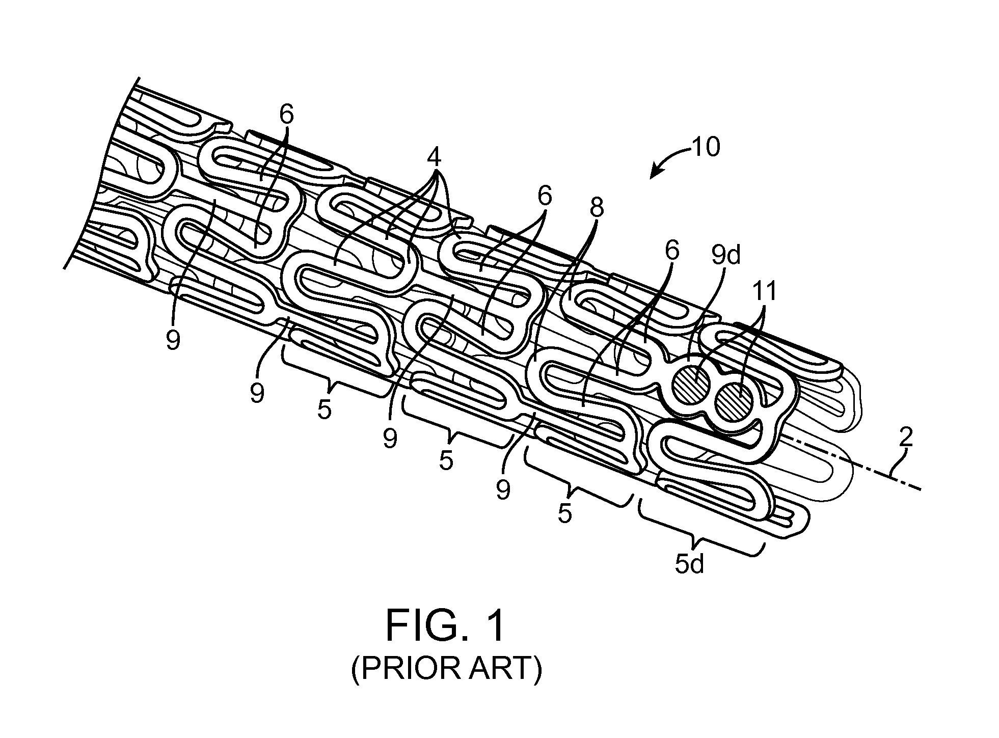 Scaffolds having radiopaque markers