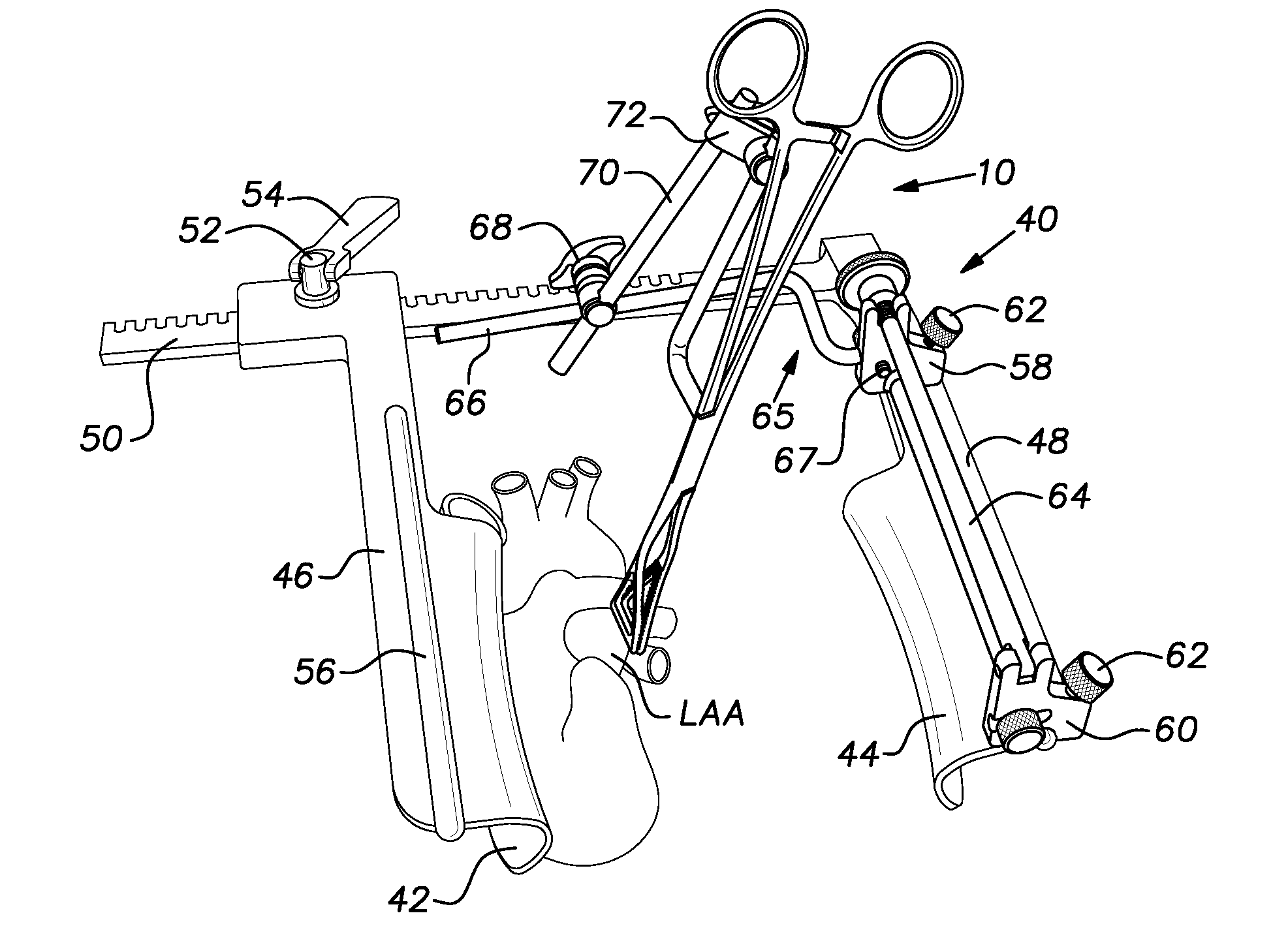 Retraction of the Left Atrial Appendage