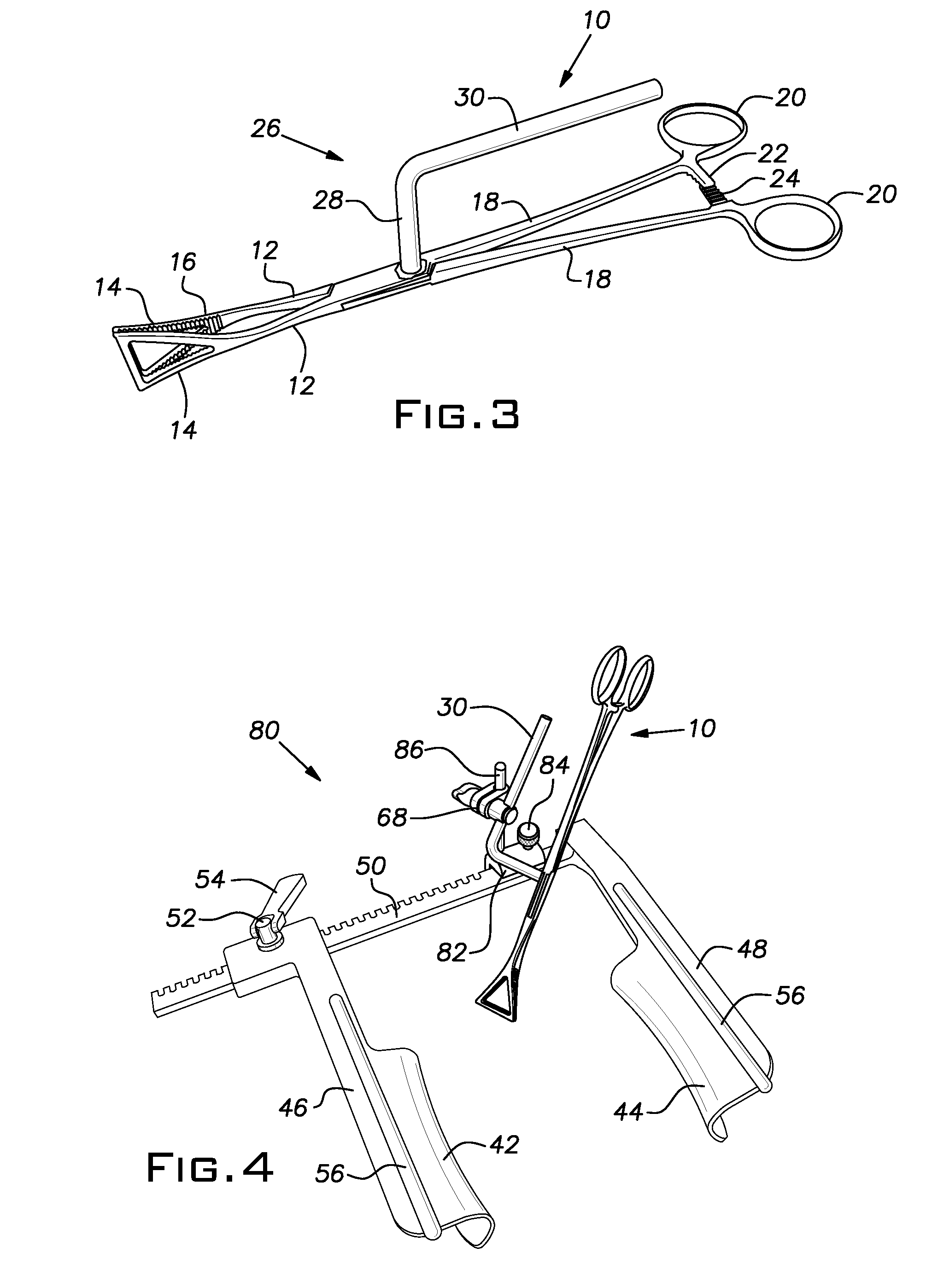 Retraction of the Left Atrial Appendage