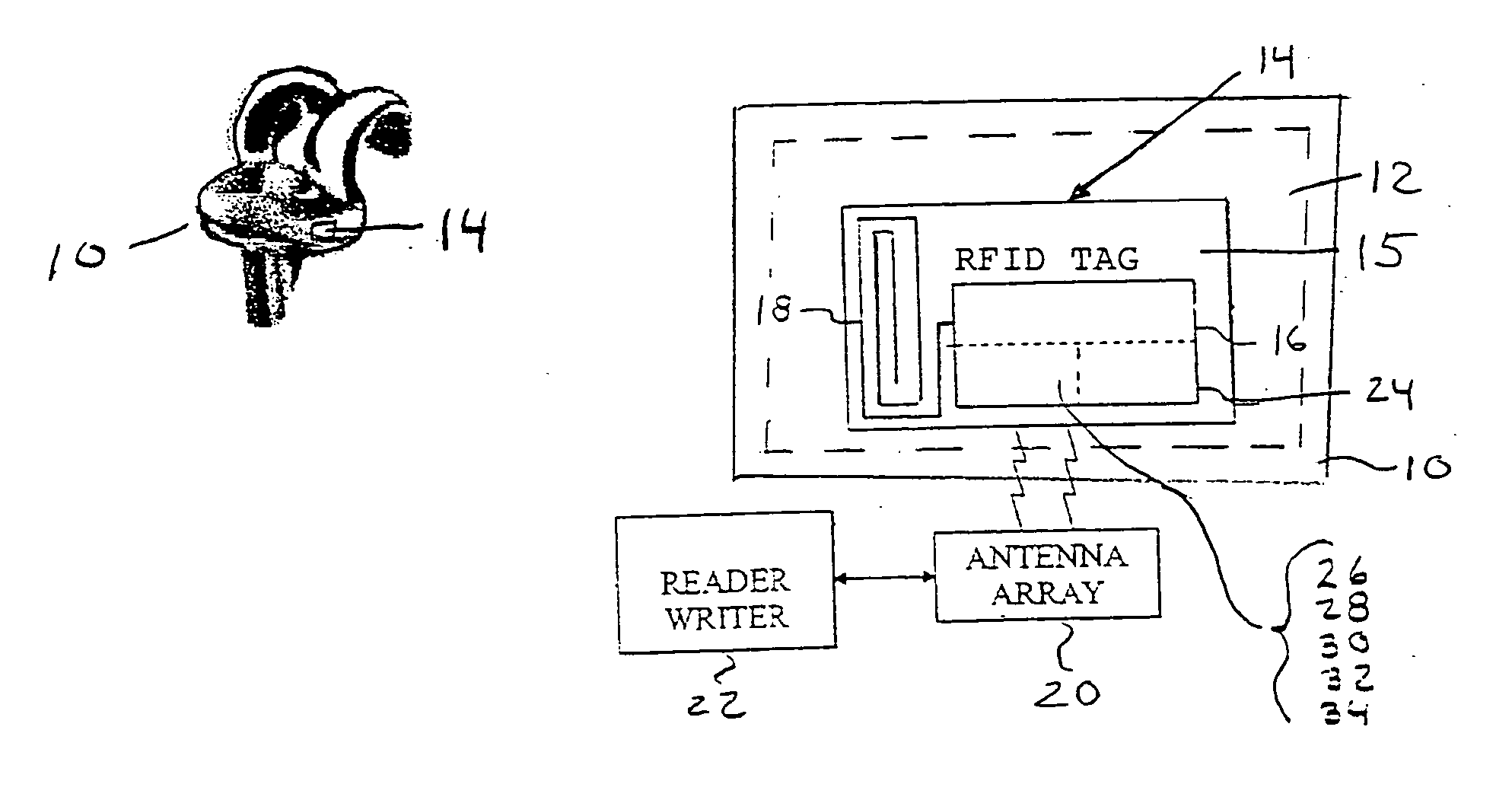 Medical implant device with RFID tag and method of identification of device