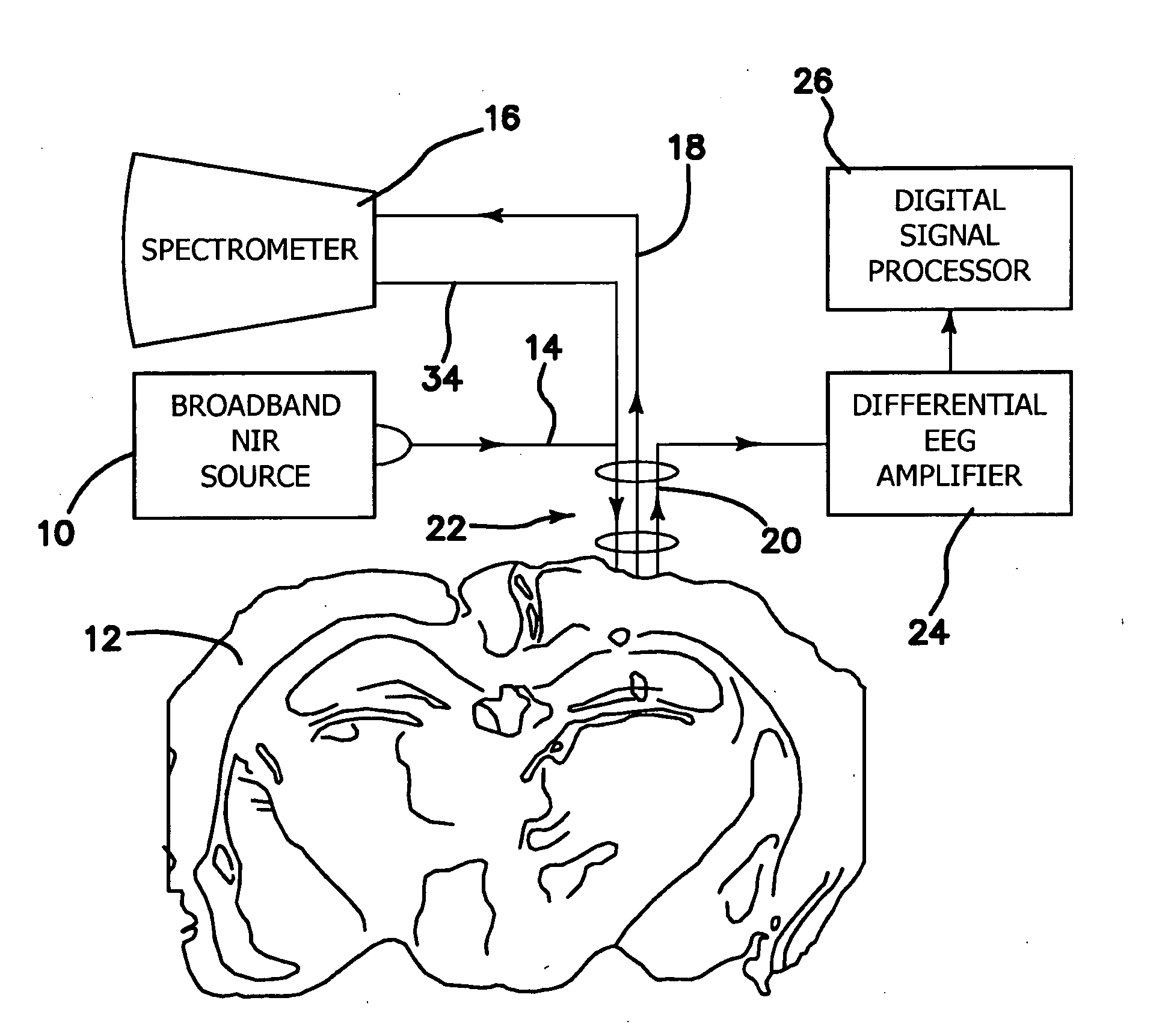 Optical detection of seizure, a pre-seizure state, and cerebral edema and optical fiber detection of the same