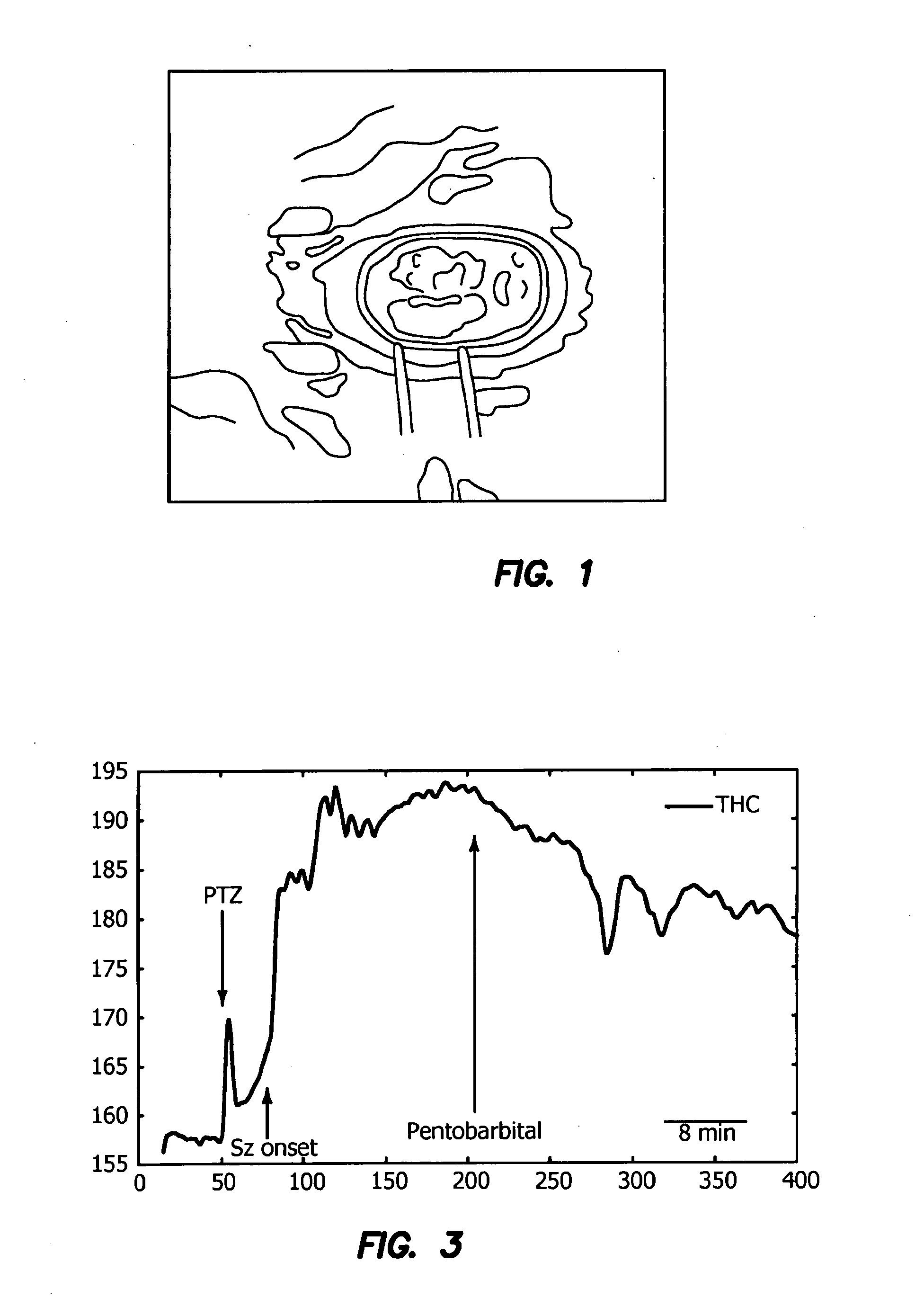 Optical detection of seizure, a pre-seizure state, and cerebral edema and optical fiber detection of the same