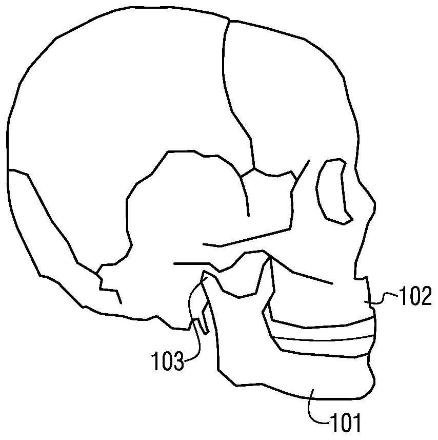 A method of using a central relationship position demonstration device