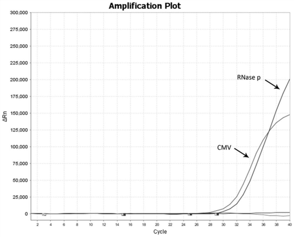 Multiplex fluorescent quantitative RT-PCR (reverse transcription-polymerase chain reaction) kit for detecting hematogenous infectious viruses