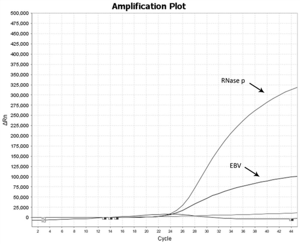 Multiplex fluorescent quantitative RT-PCR (reverse transcription-polymerase chain reaction) kit for detecting hematogenous infectious viruses