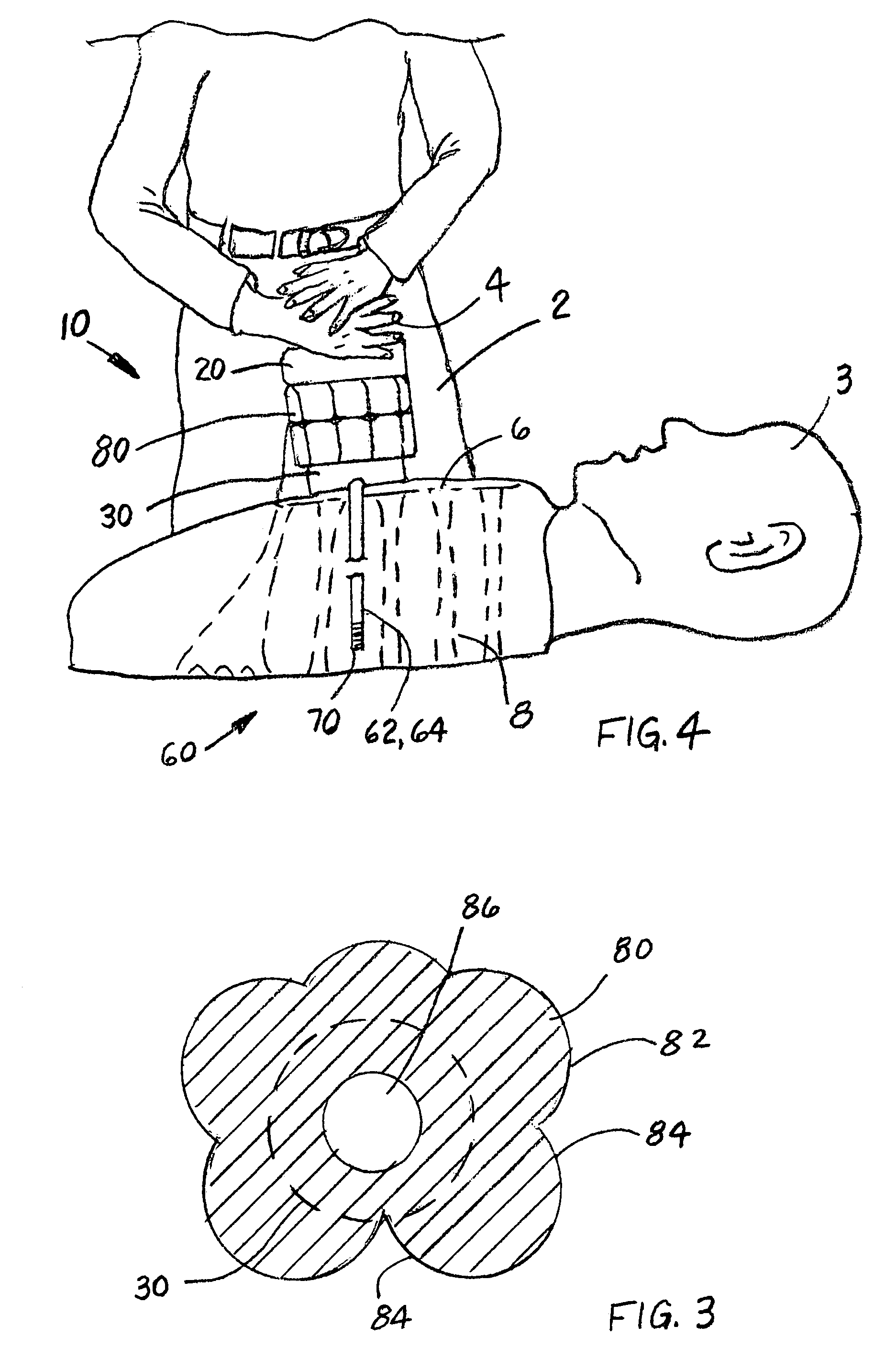 Device and kit for assisting in cardiopulmonary resuscitations