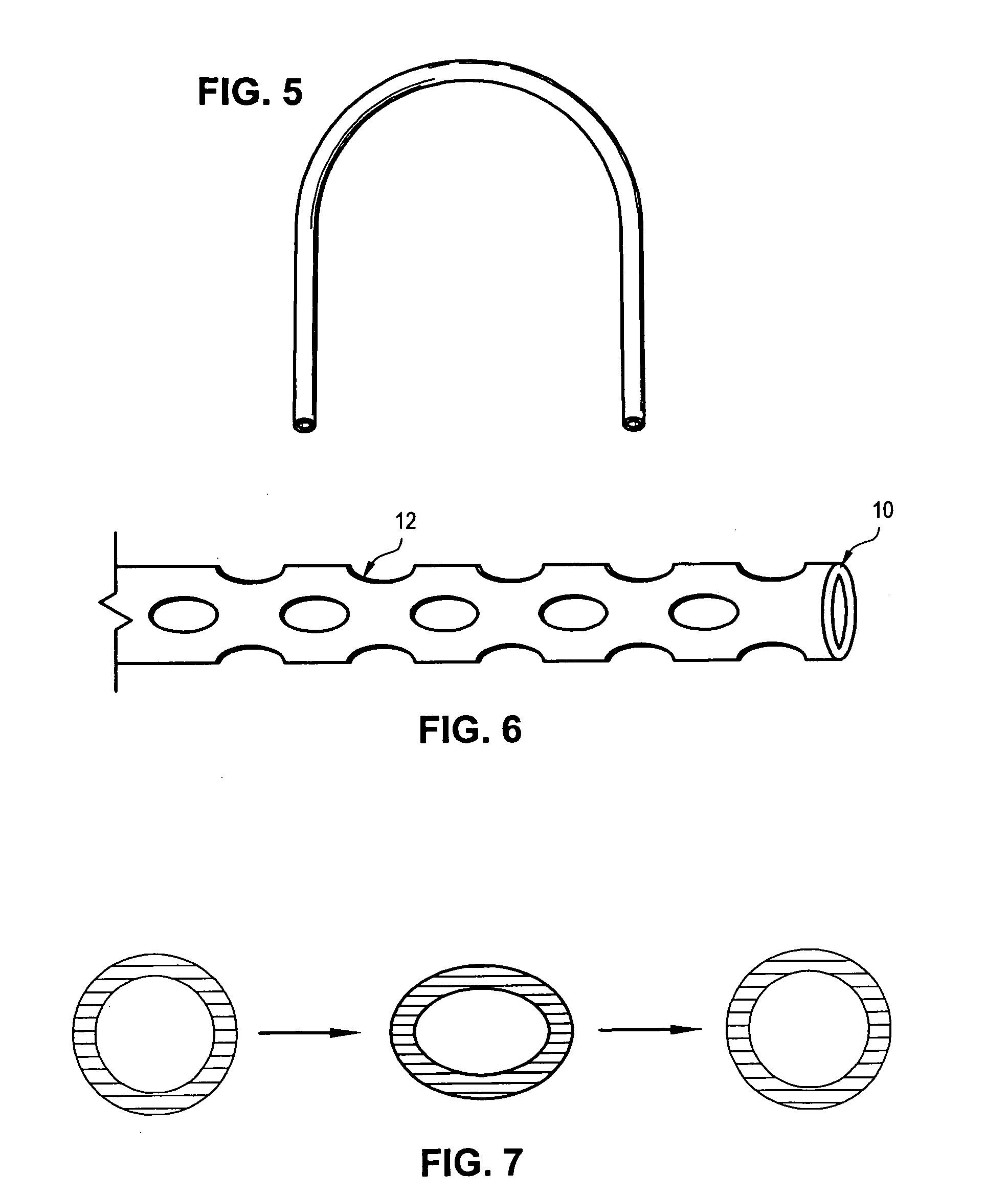 Tubular orthodontic arch wire